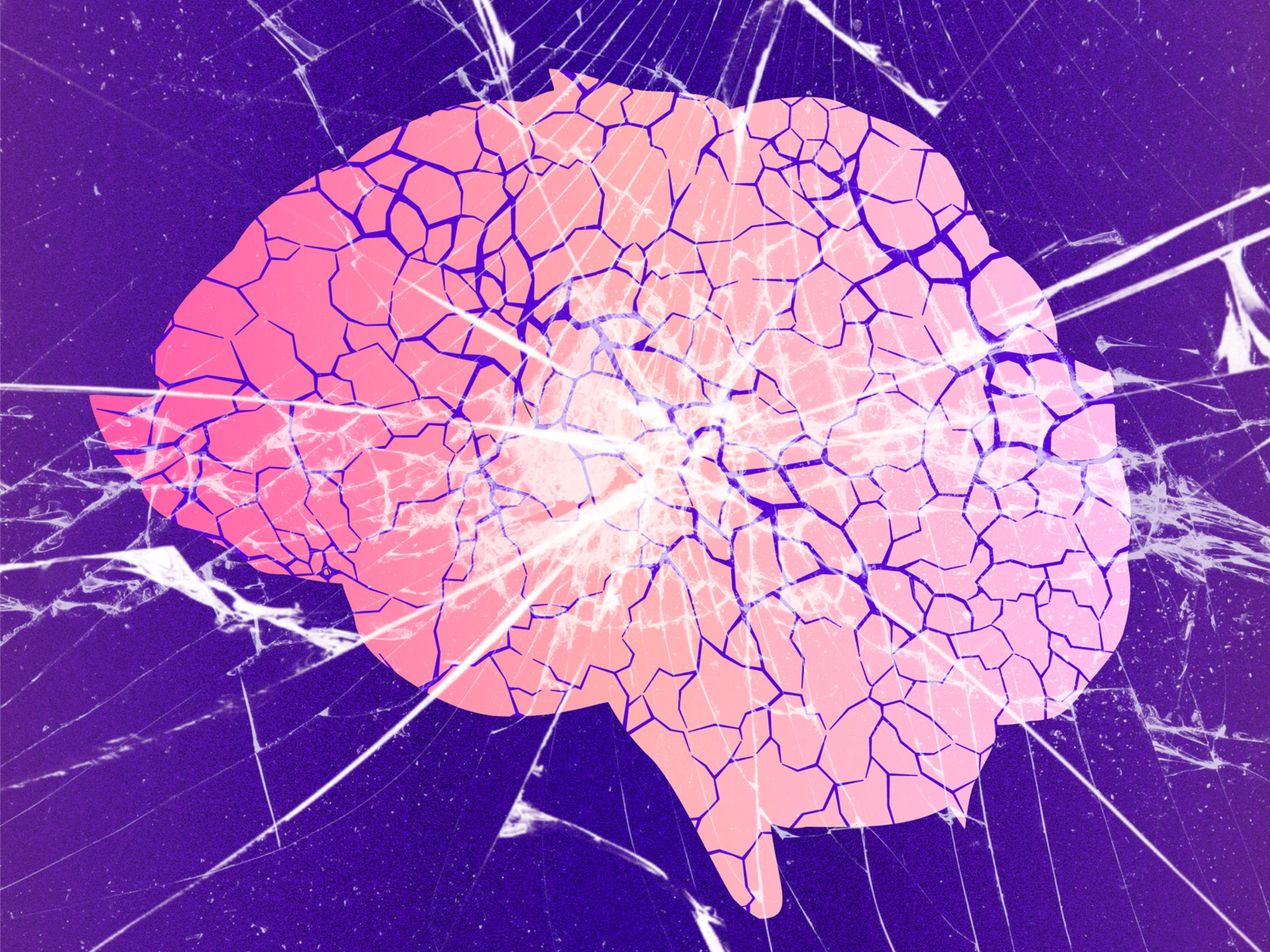 Una ilustración de un cerebro roto por el alzhéimer