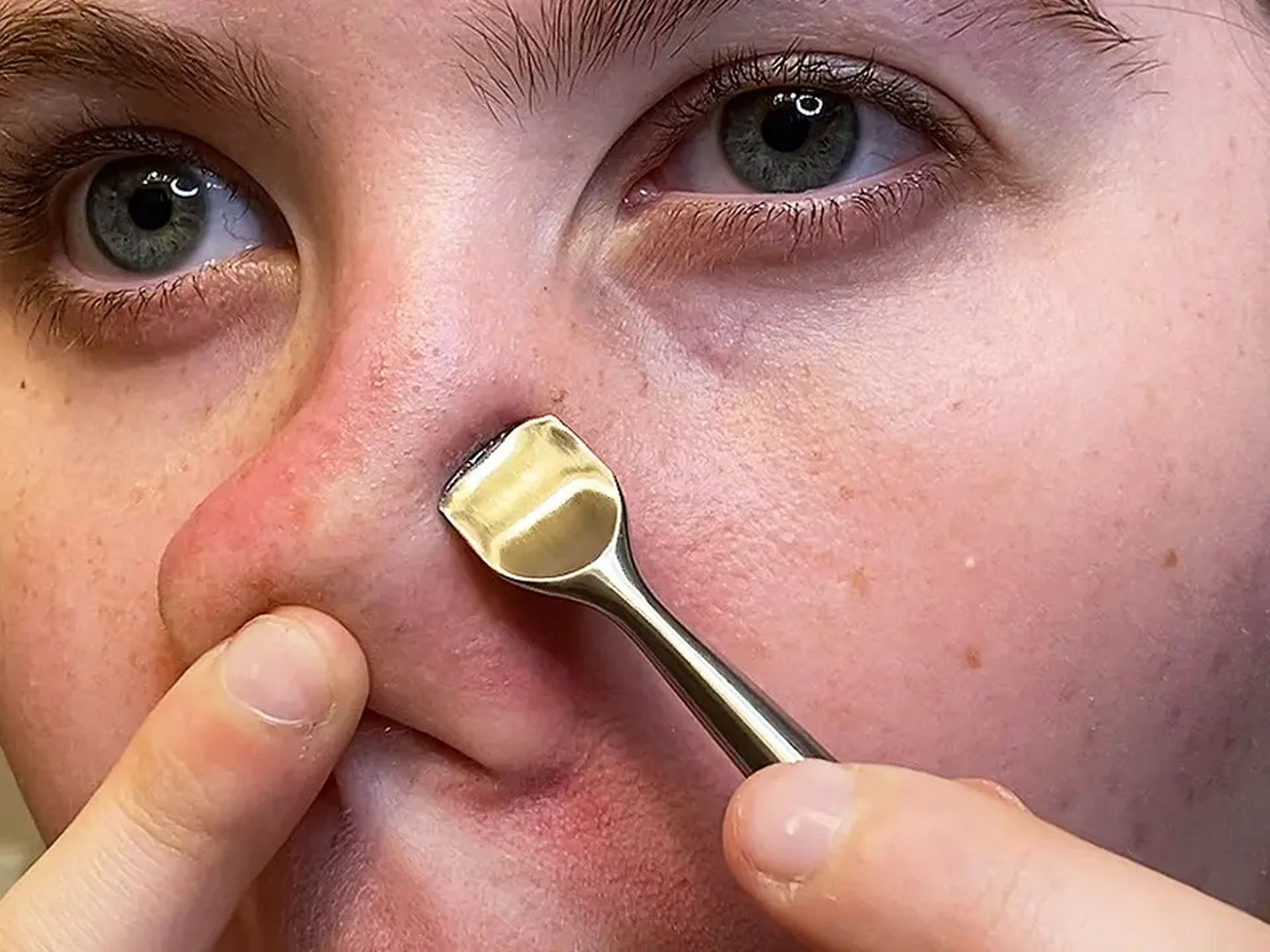 Woman using a pore scraping tool on her nose.