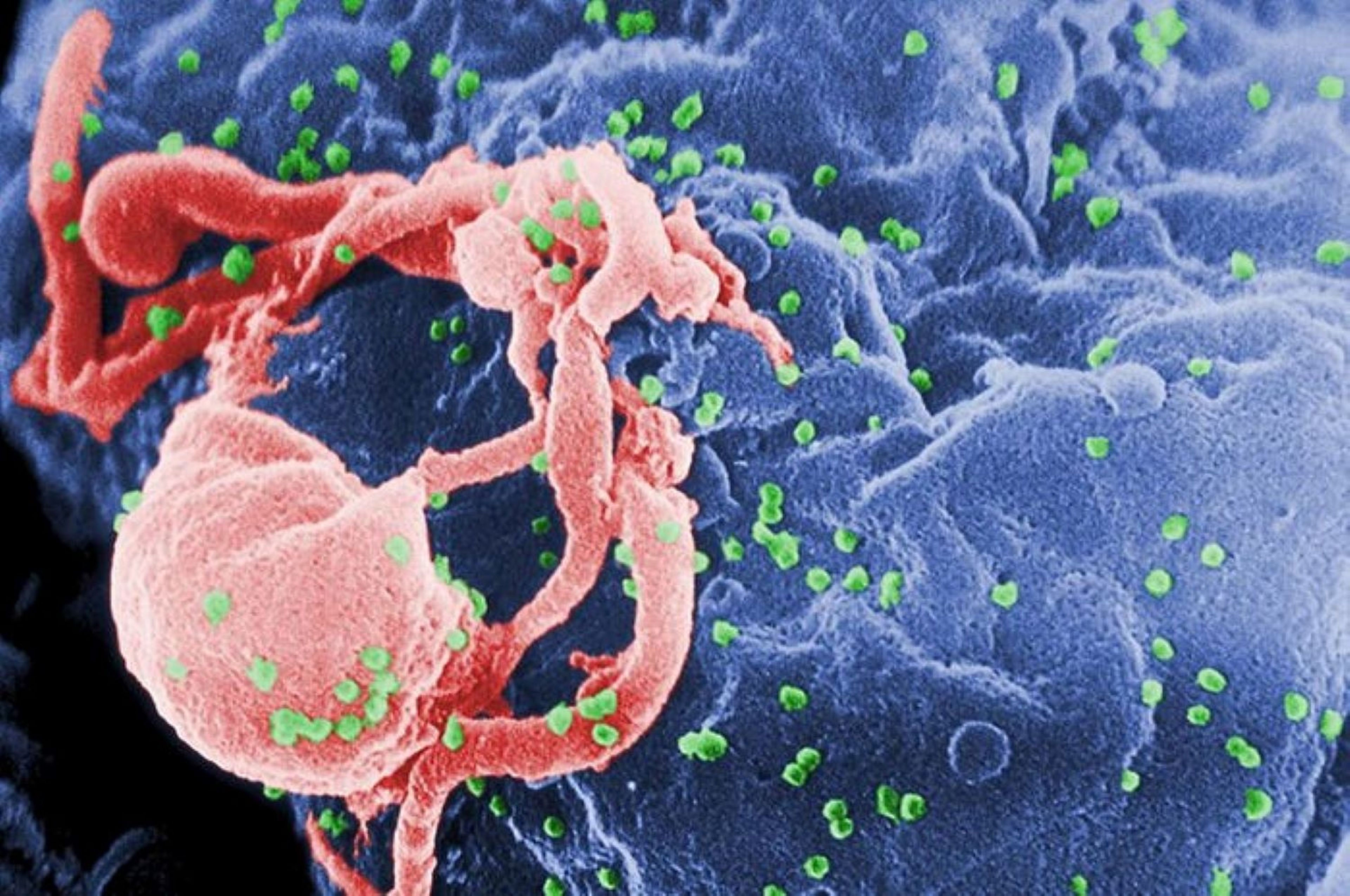 VIH se adhiere a una célula humana.
