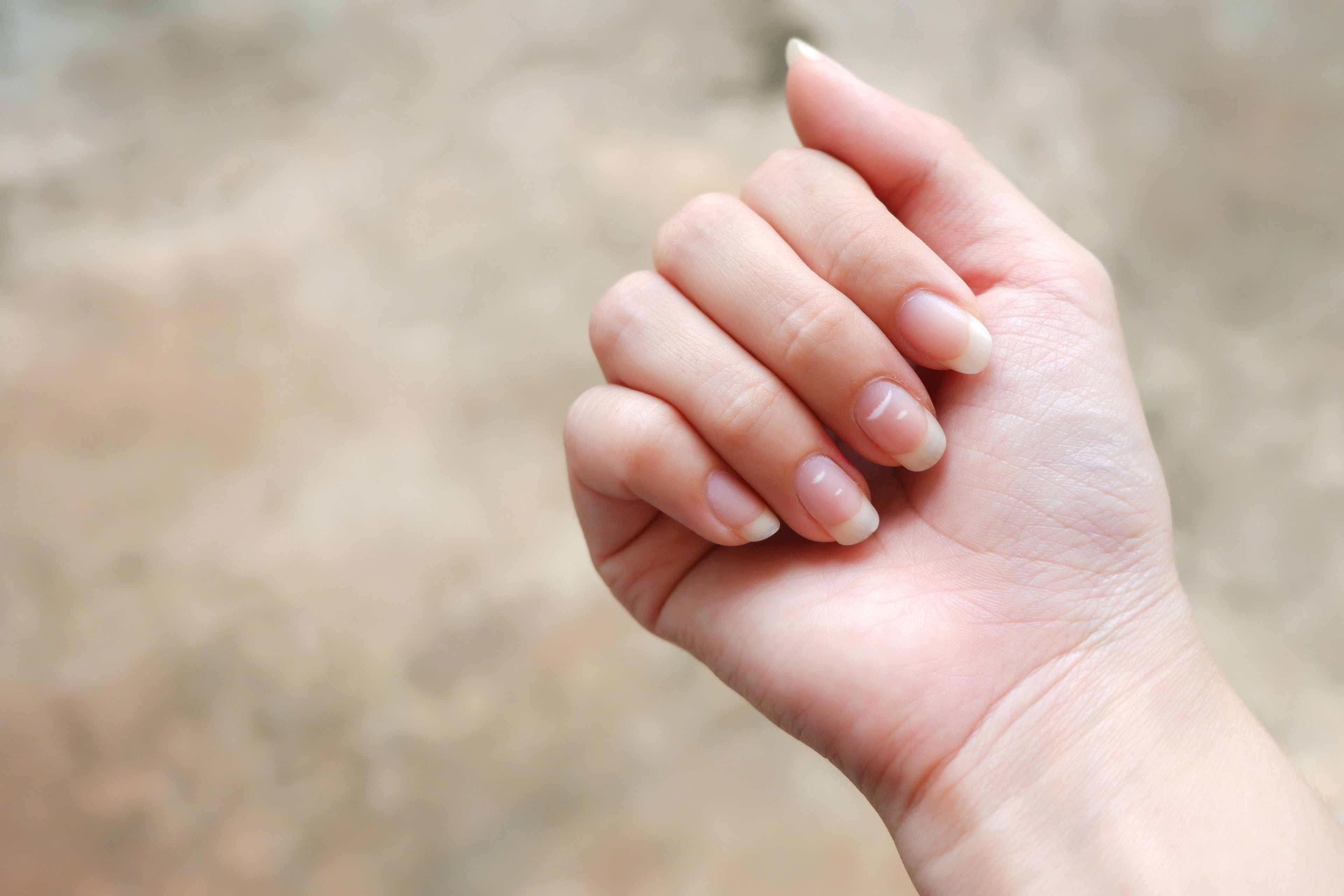 manchas blancas uñas