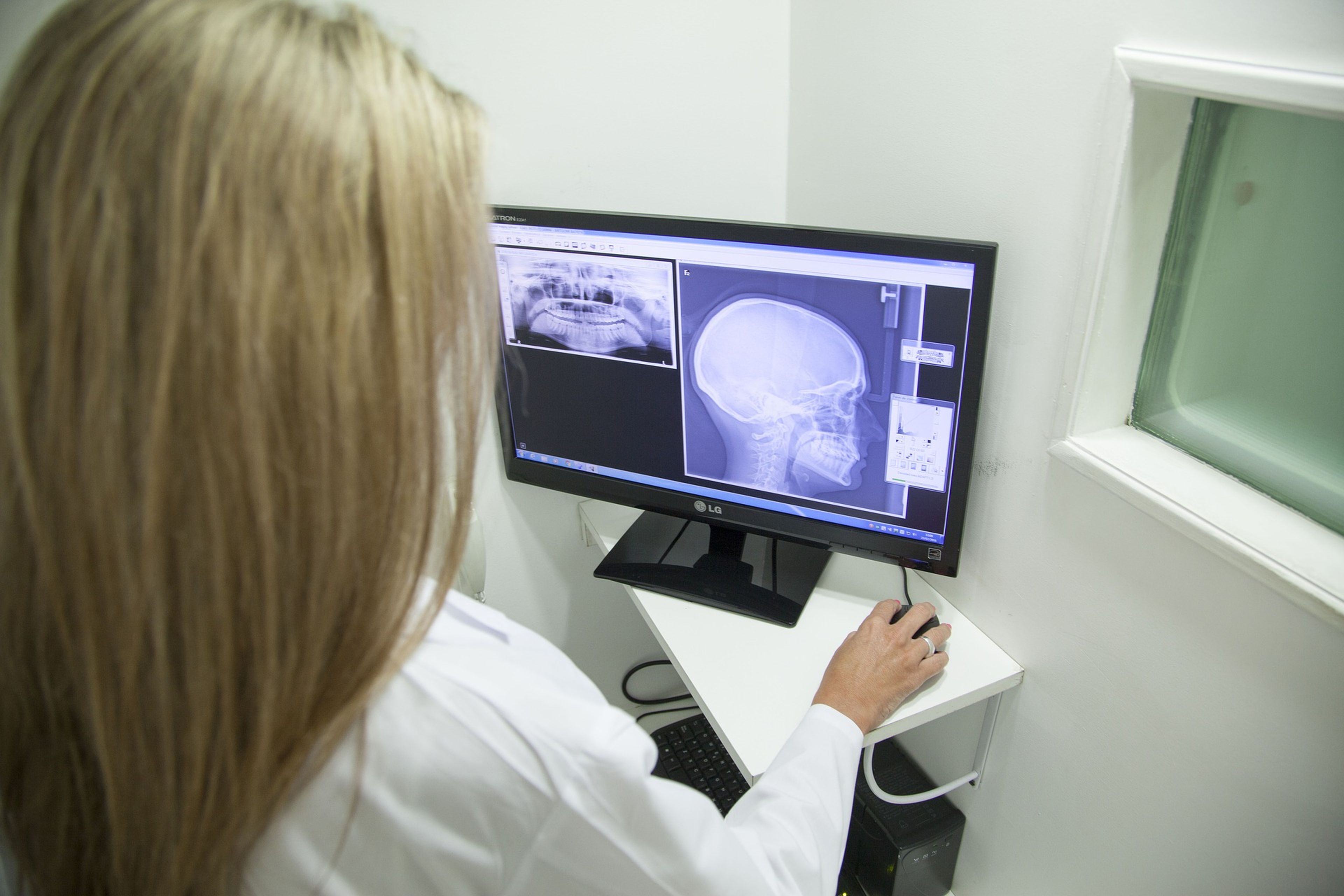 Una mujer mira una radiografía.