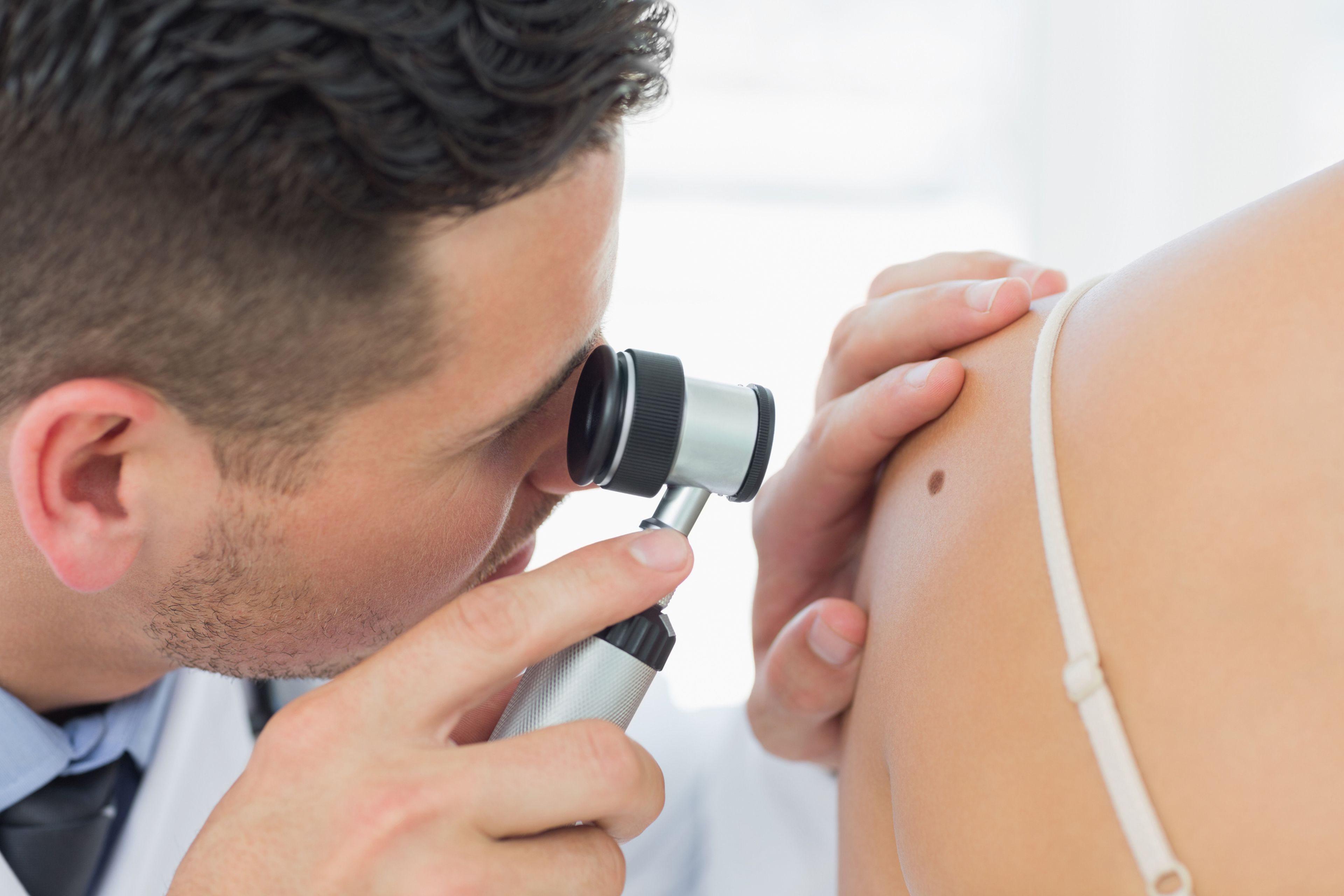 Dermatólogo mirando un posible melanoma
