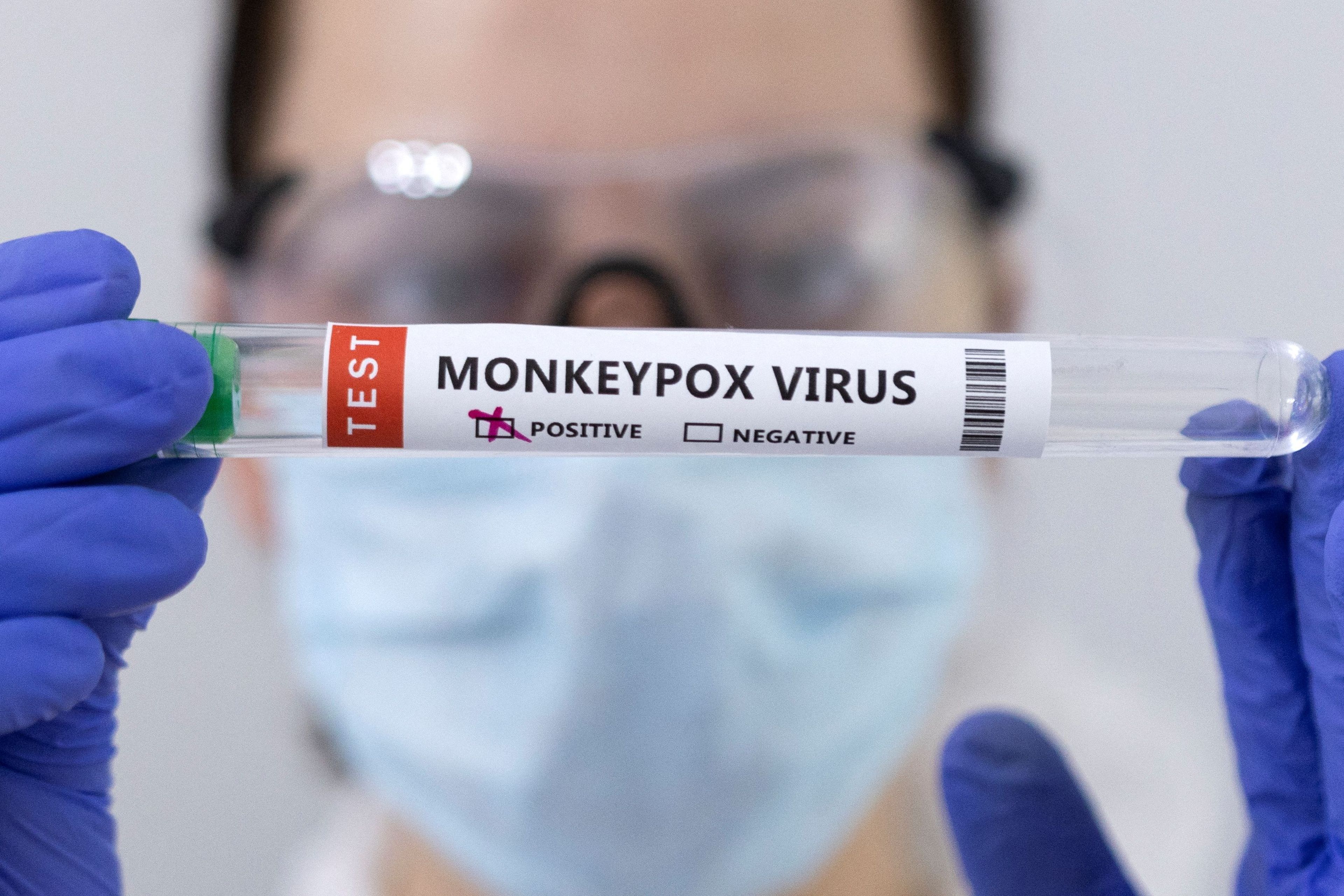 Investigadora con un tubo de ensayo de la viruela del mono