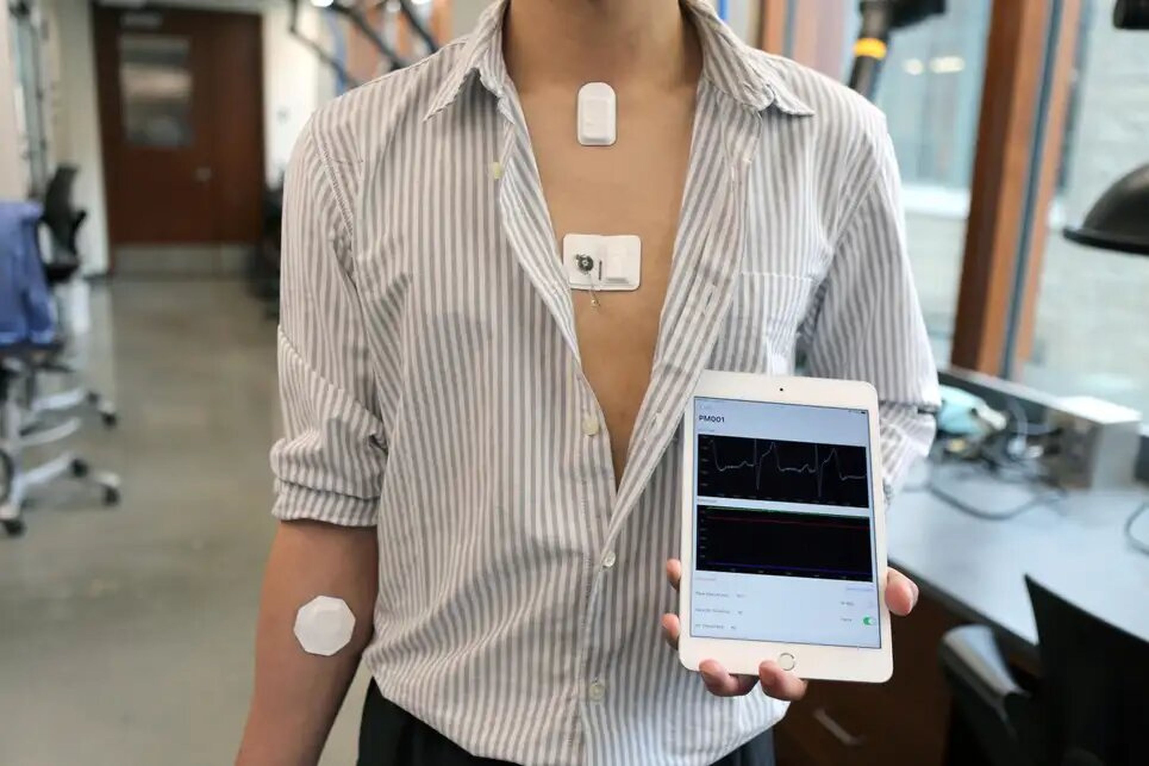 Un voluntario demuestra los sensores inalámbricos y la unidad de control del sistema del marcapasos, que también puede enviar los datos a una app.