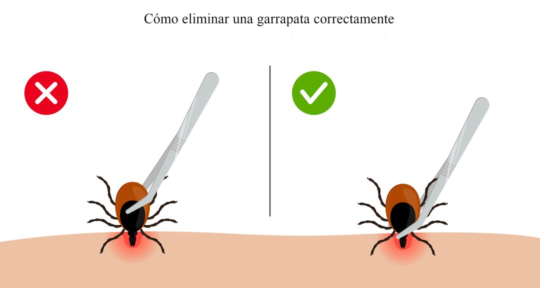 Consejos para prevenir las picaduras de garrapatas en verano Business Insider España Consejos para prevenir las picaduras de garrapatas en verano Business Insider España
