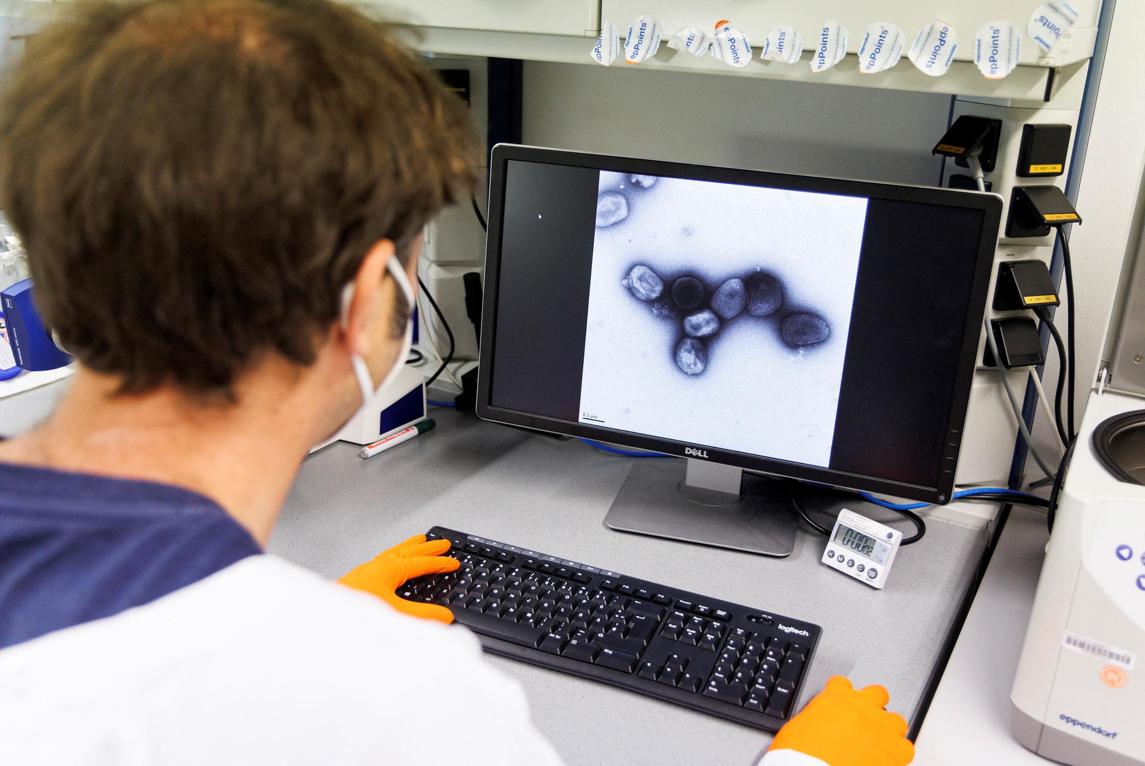 Viruela del mono observada en un laboratorio de Bavarian Nordic