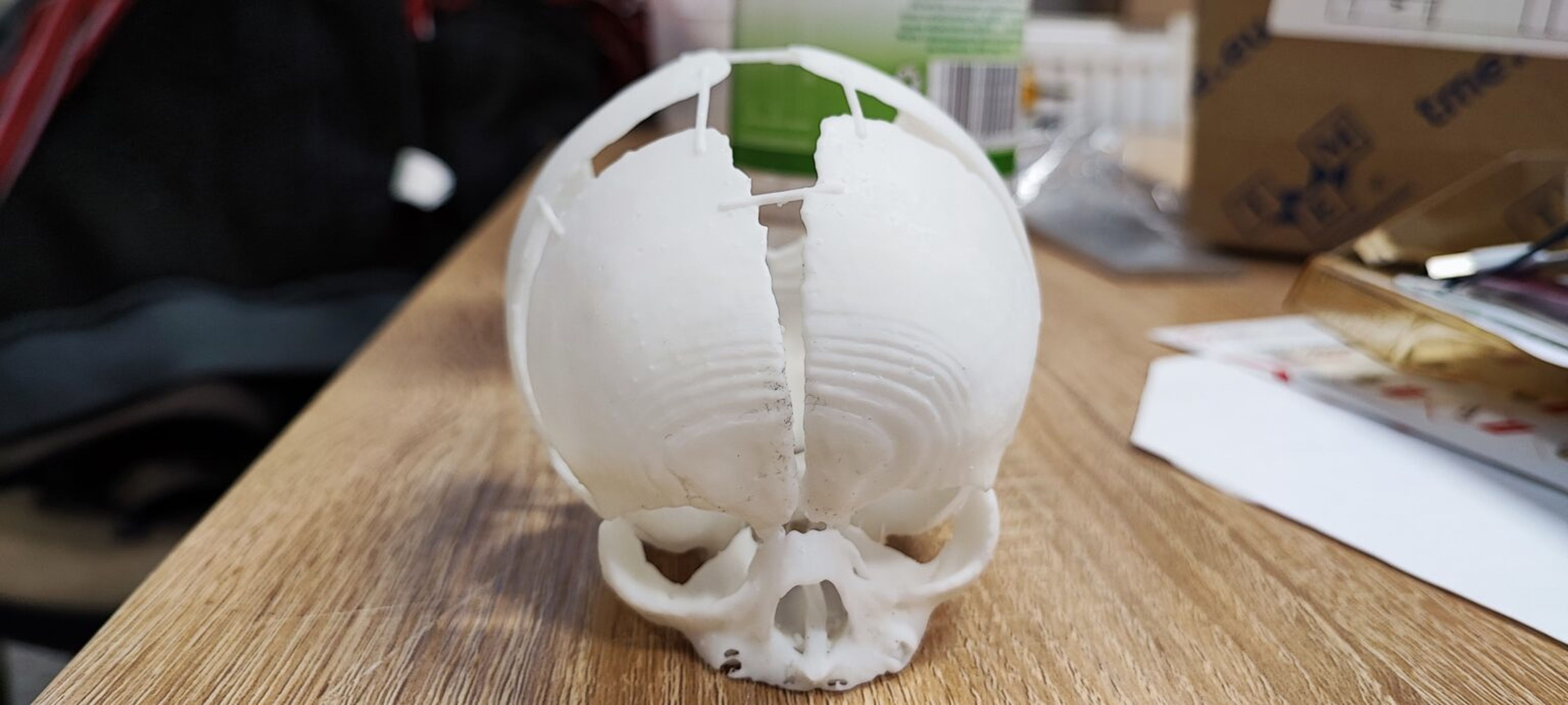 Cráneo impreso 3D