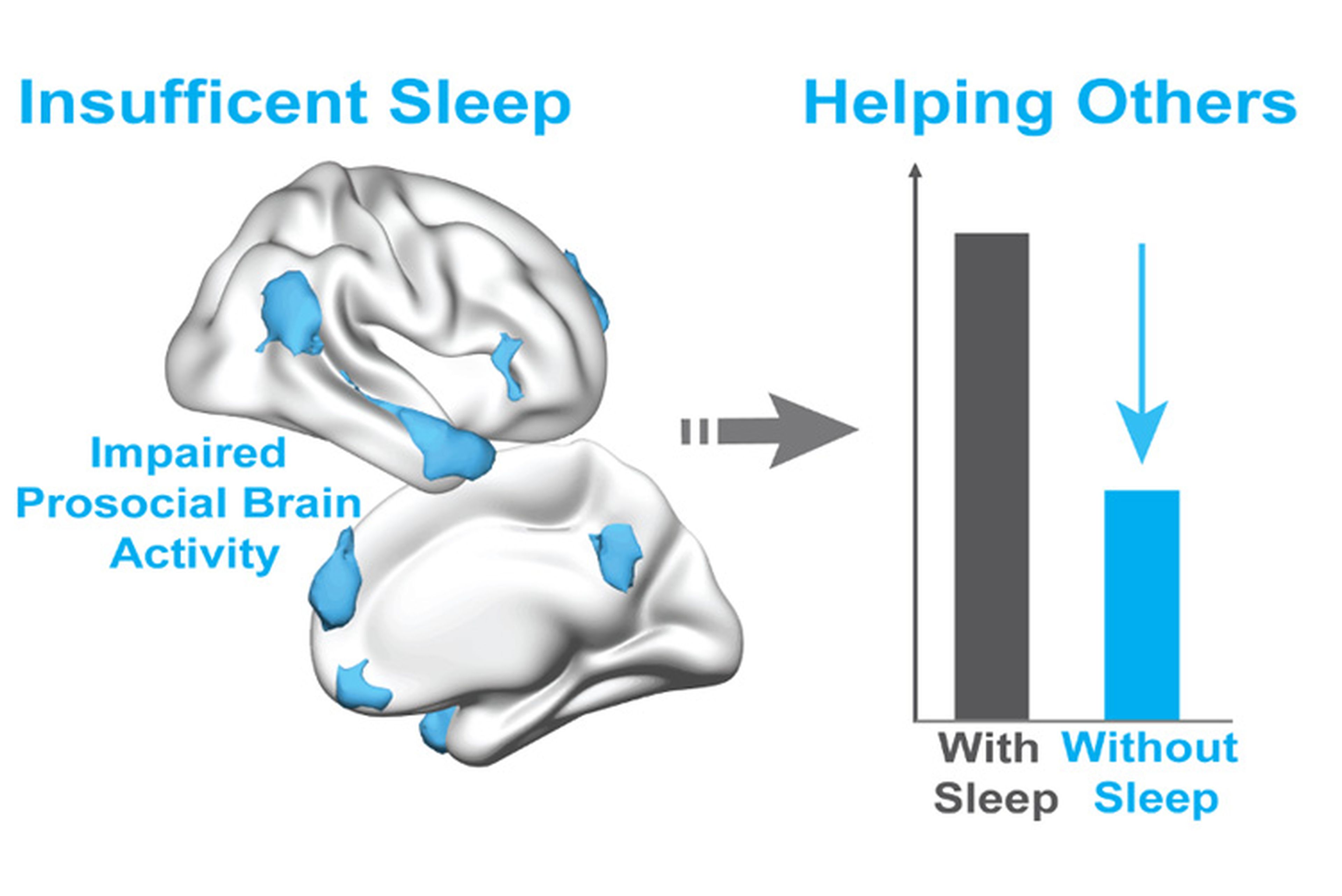 Gráfico sobre la falta de sueño