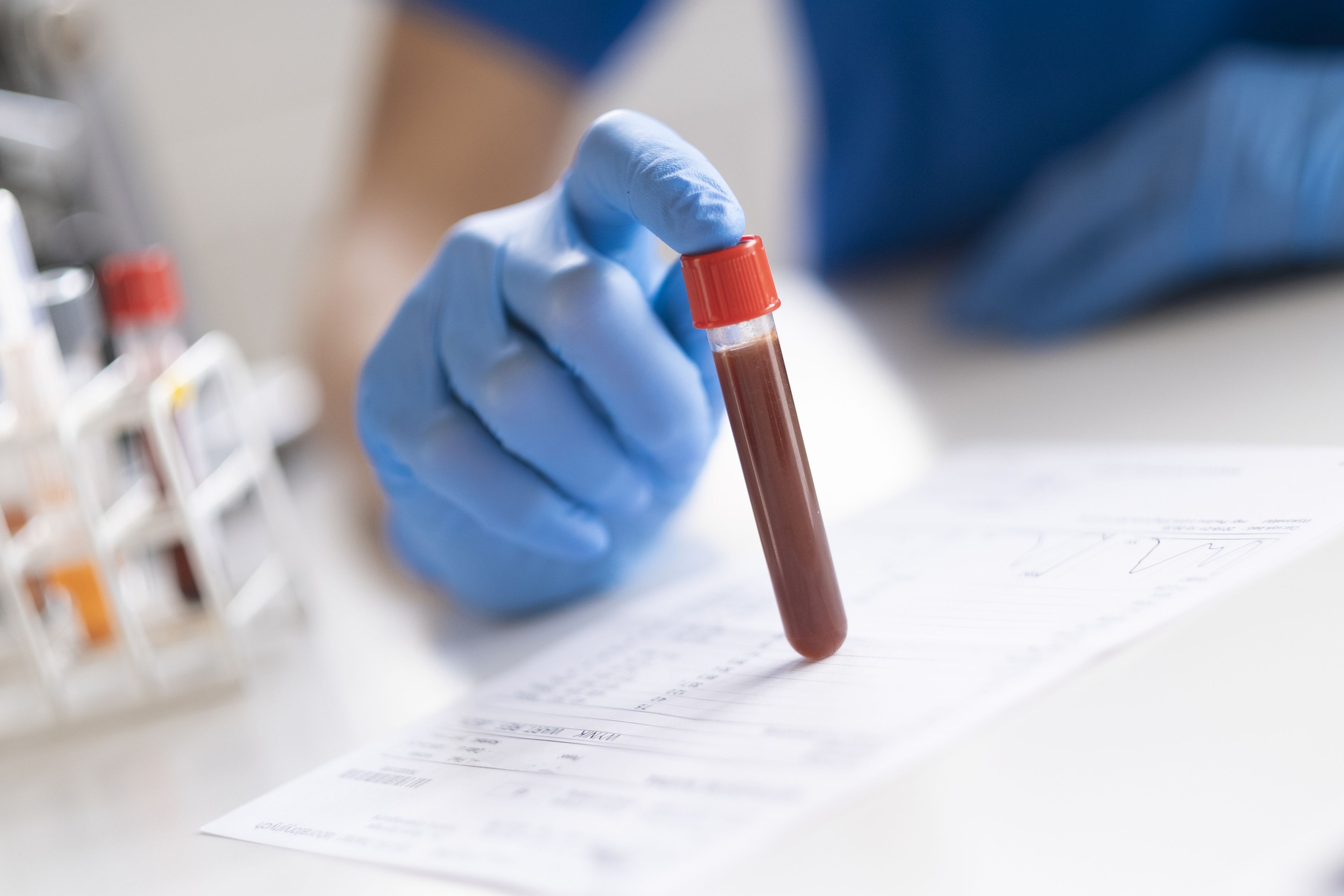 Es la primera vez que los resultados de la prueba Galleri, que busca el ADN del cáncer en la sangre, se devuelven a los pacientes y sus médicos.