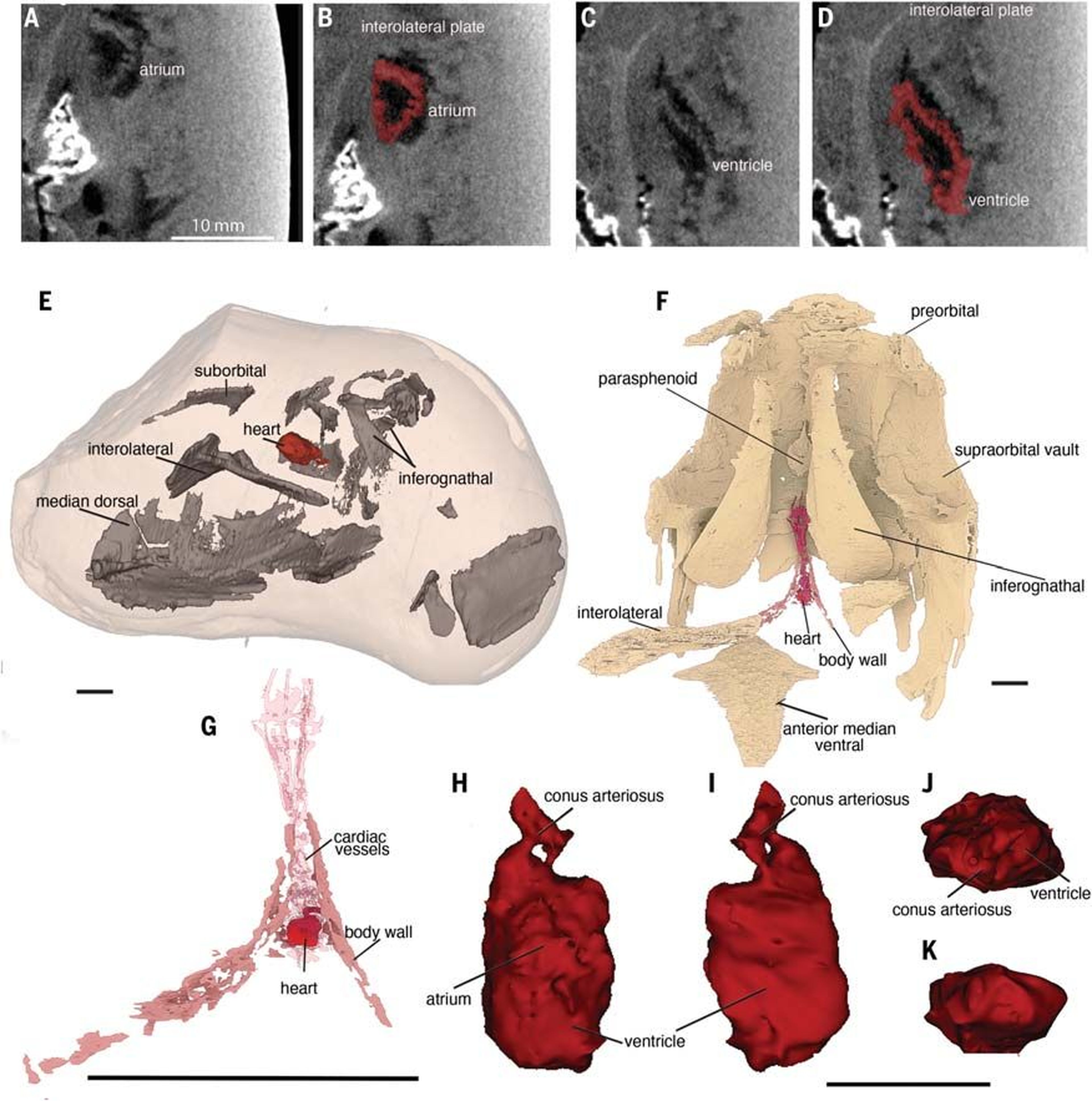 Detalles del escaneo del corazón más antiguo del mundo.