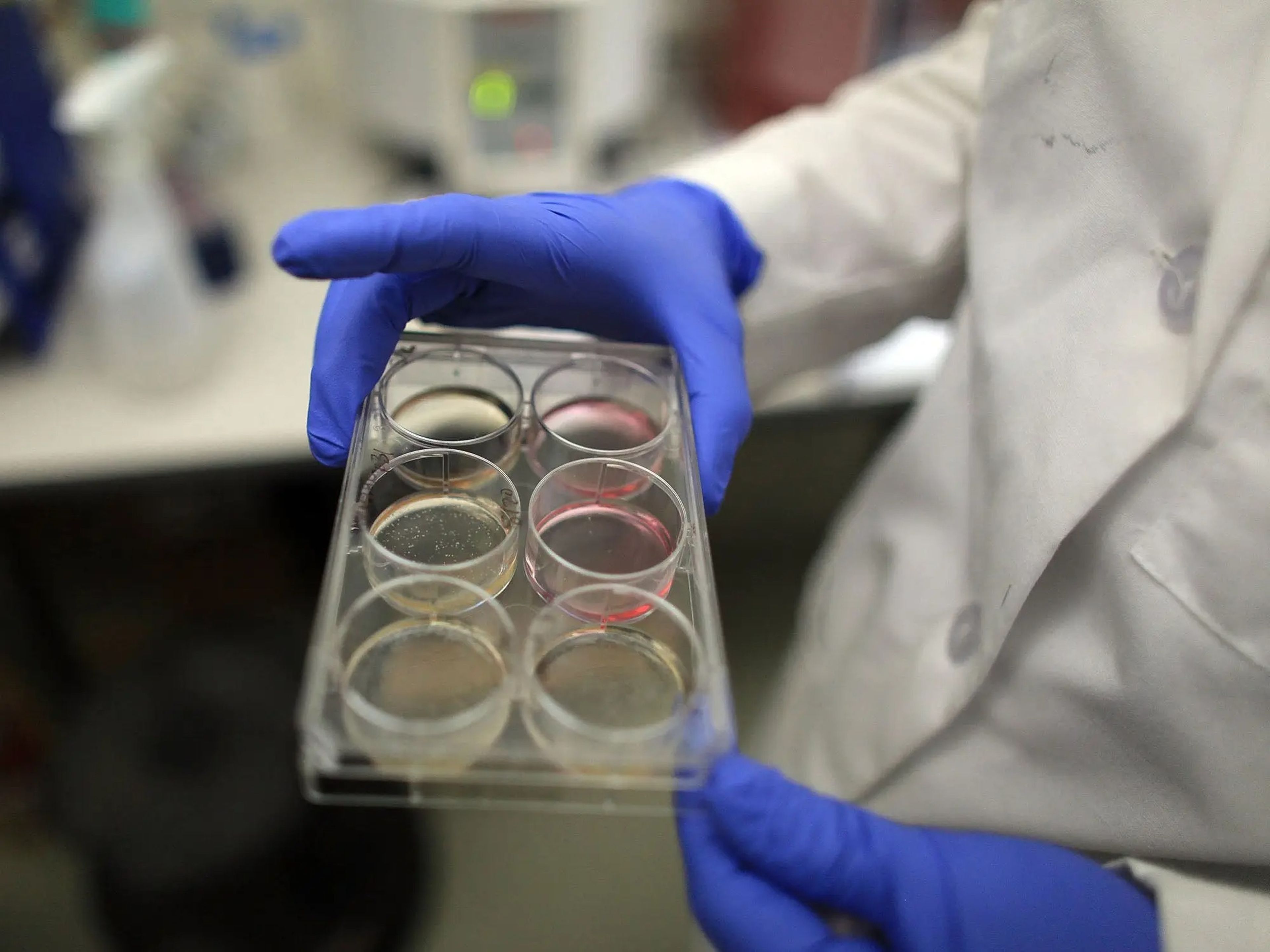 La investigadora Stormy Chamberlain sostiene una bandeja de células madre en el Instituto de Células Madre de la Universidad de Connecticut.