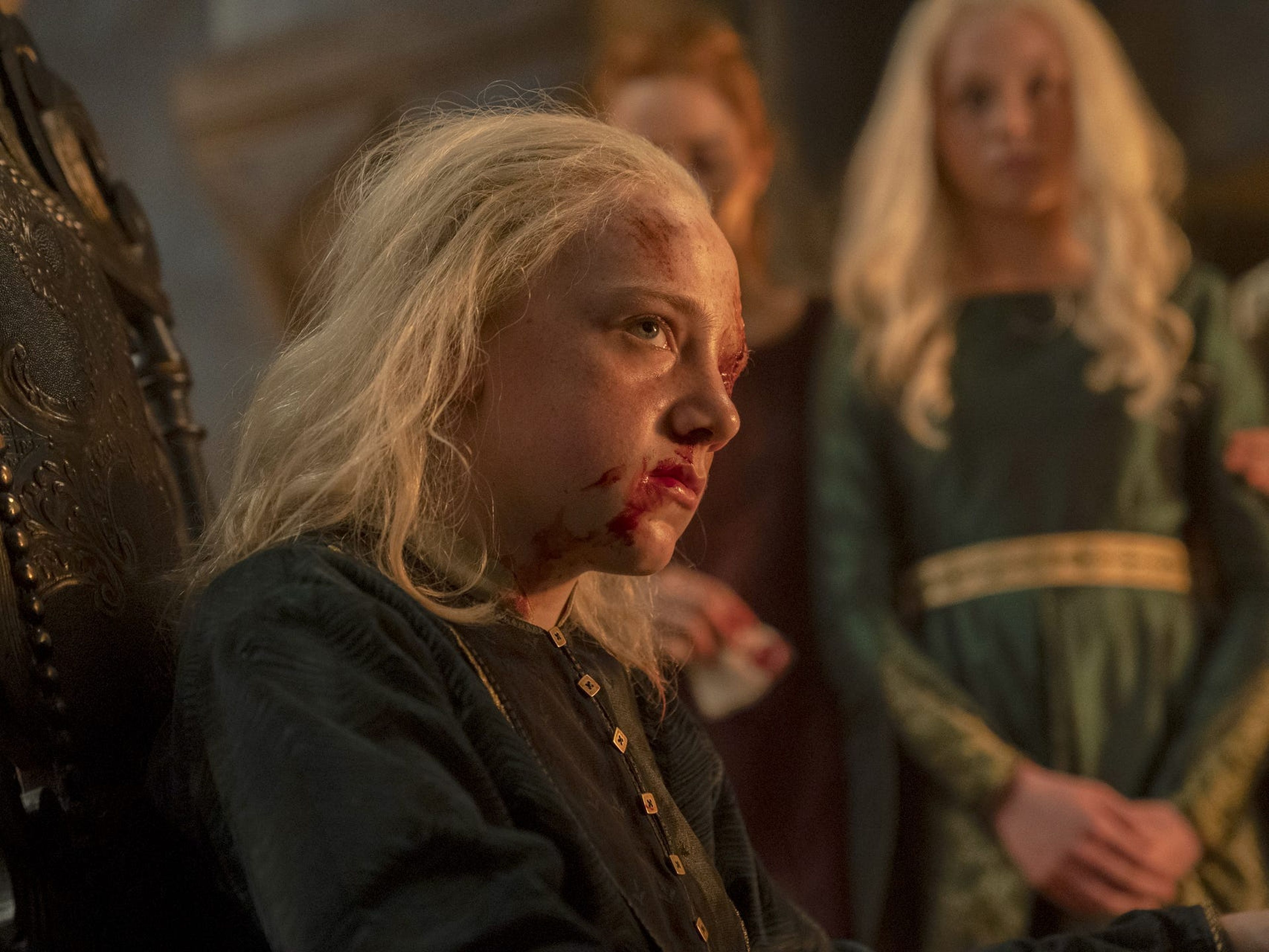 Aemond Targaryen en el séptimo episodio de la primera temporada de 'La casa del dragón'.