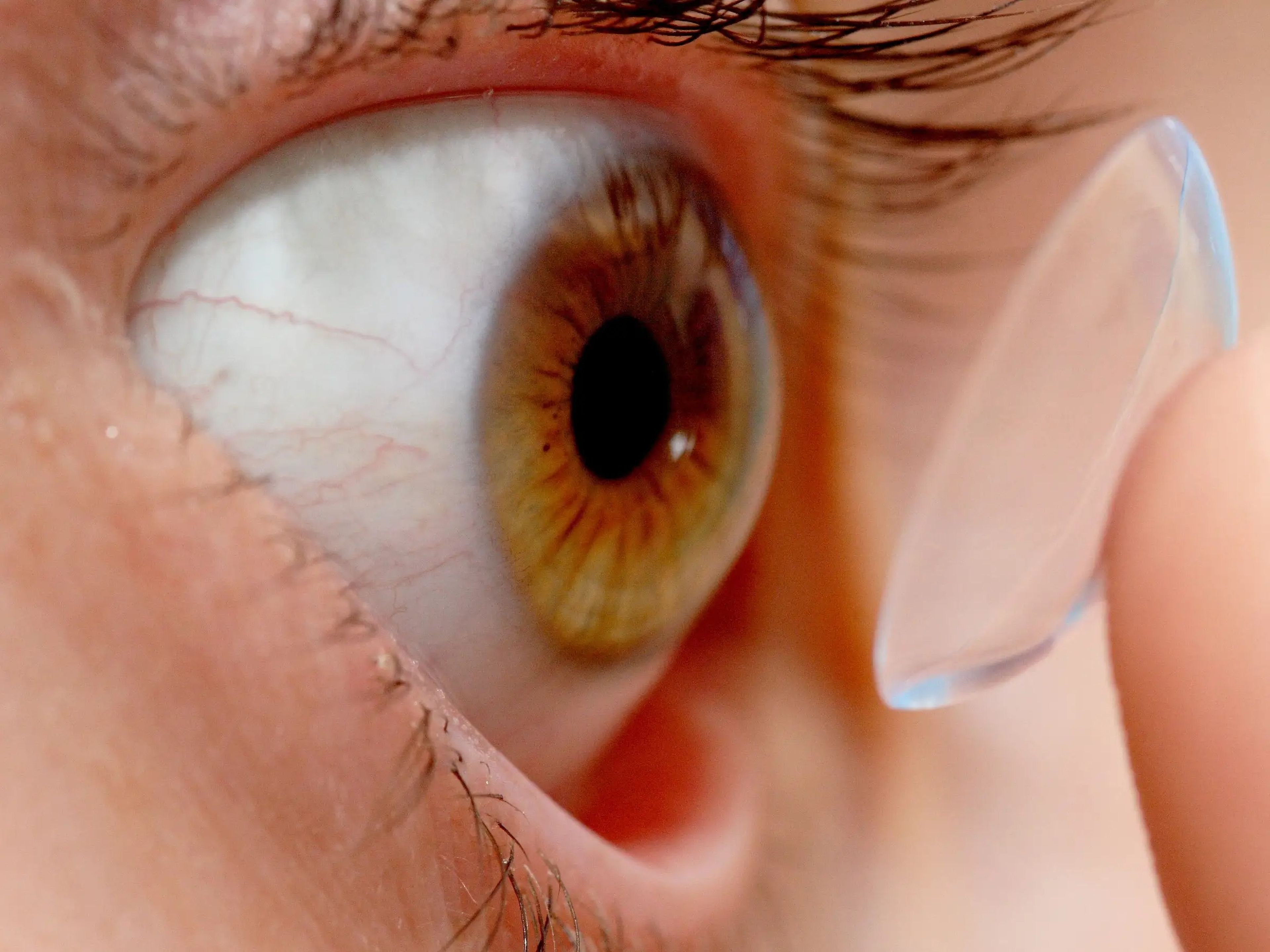 Una persona poniéndose una lente de contacto en el ojo.