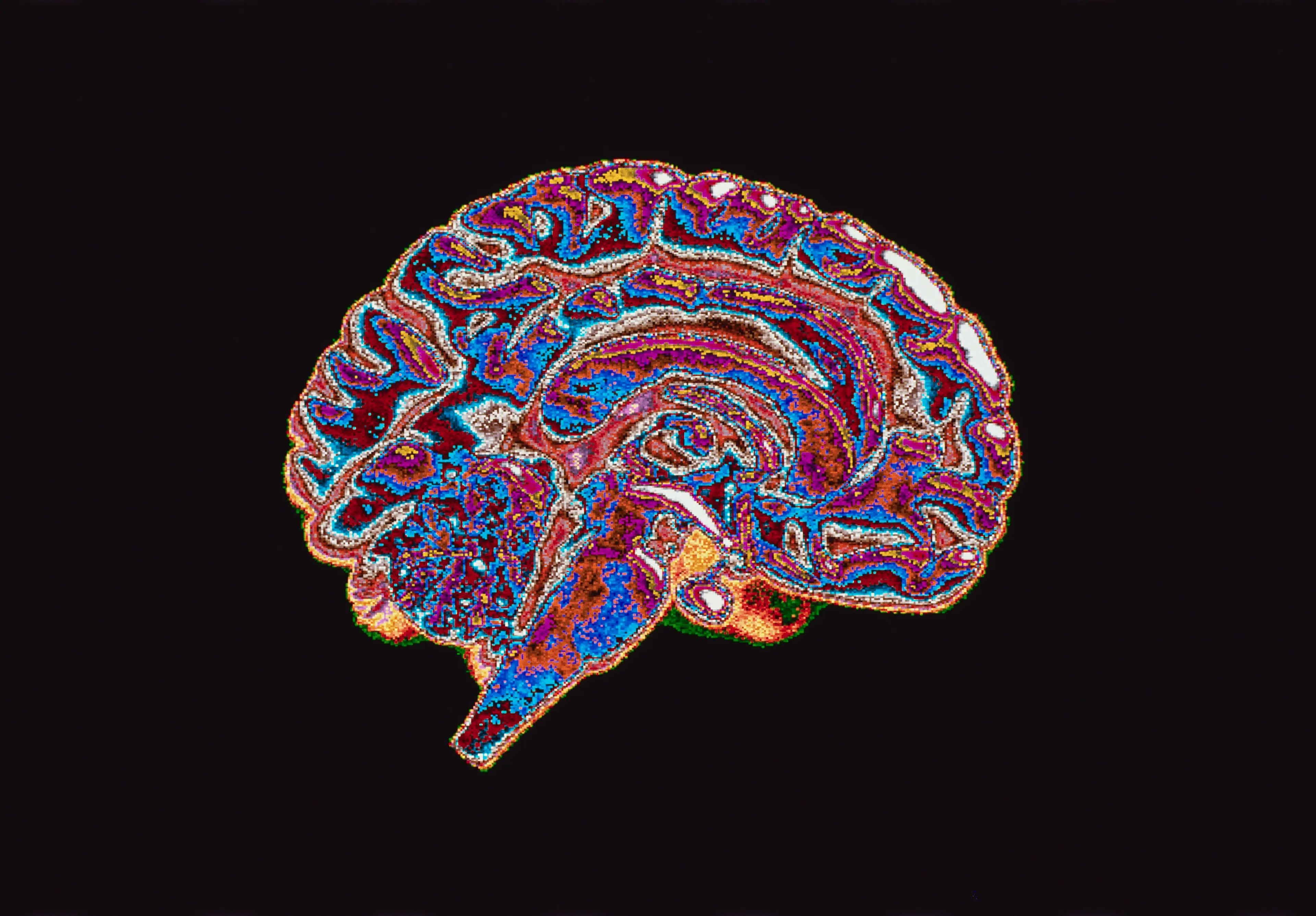 Digital art of colorful brain scan