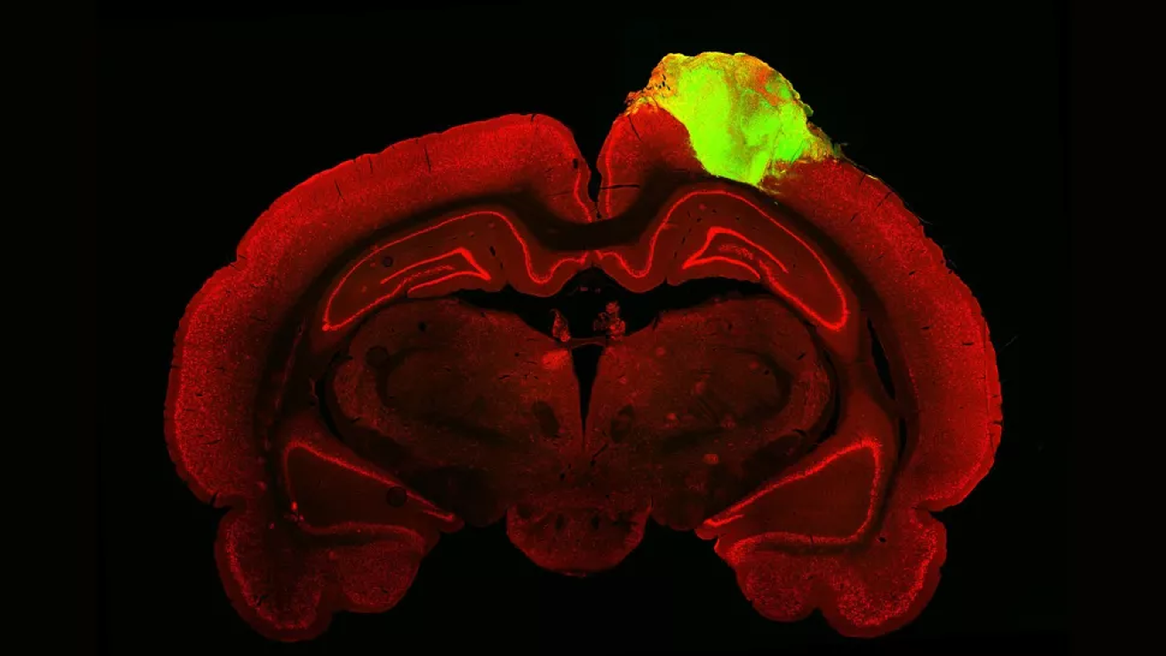 Los científicos trasplantaron un grupo organizado de células cerebrales humanas, u organoide (verde), en el cerebro de esta rata, que aquí se muestra como un corte transversal.