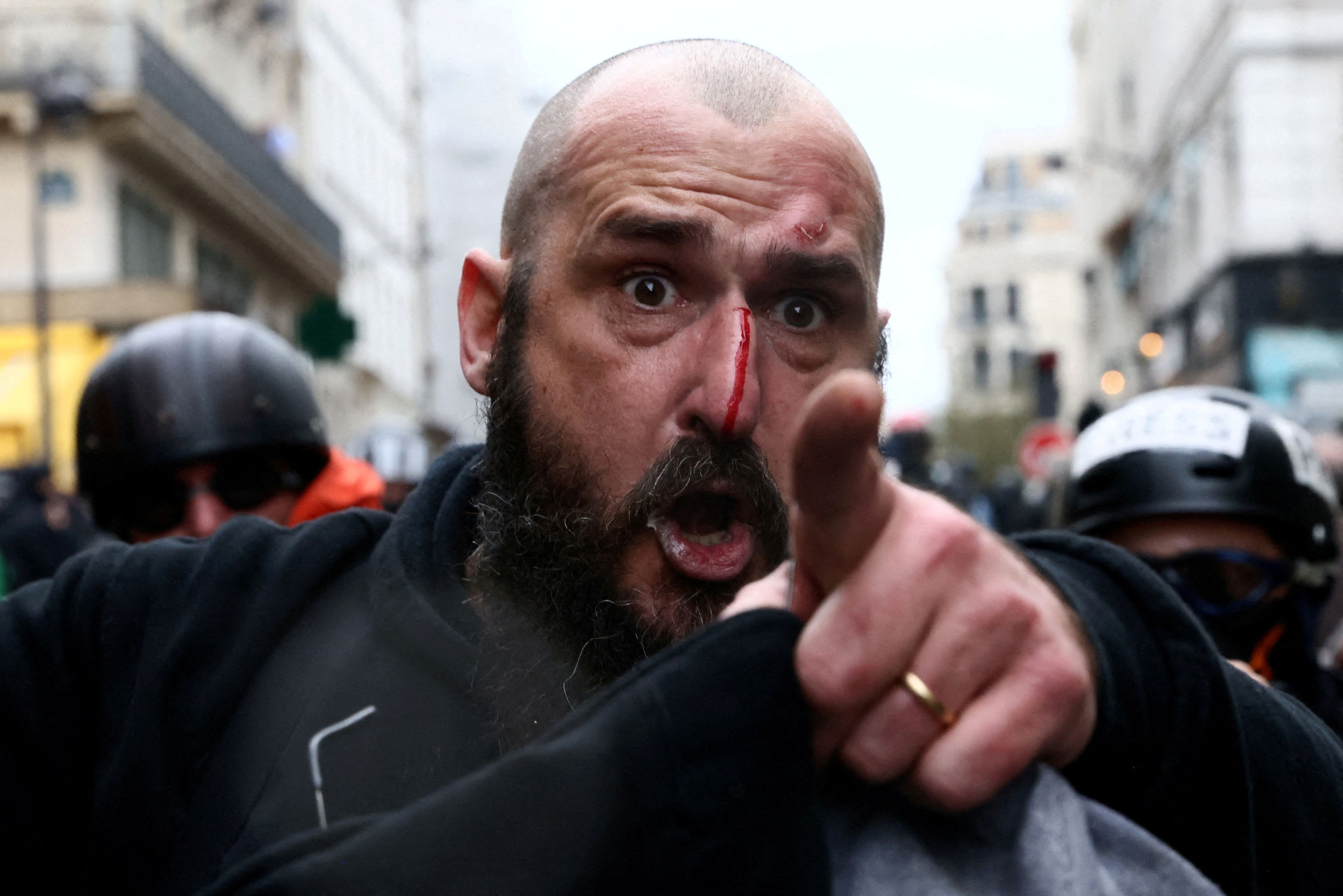 Un hombre herido durante una manifestación en el marco del noveno día de huelgas y protestas en Francia contra la reforma de las pensiones del Gobierno francés.