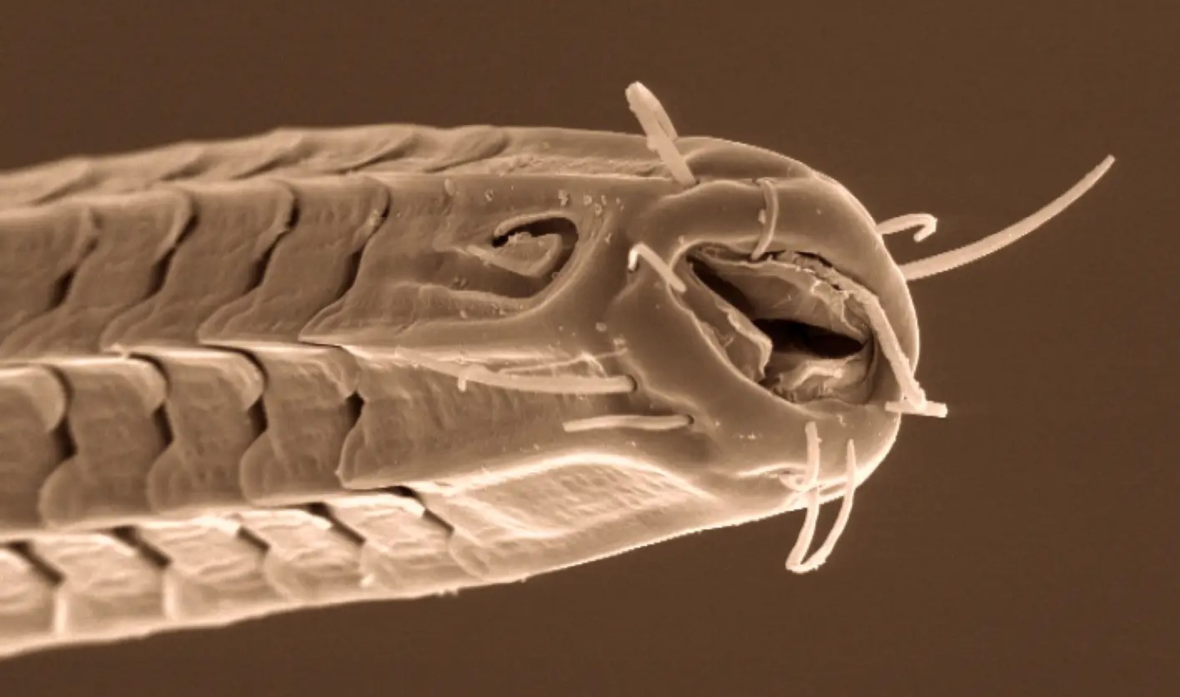 El patrón ondulado en forma de placa de este Ceramonema es lo que lo distingue de otros nematodos.