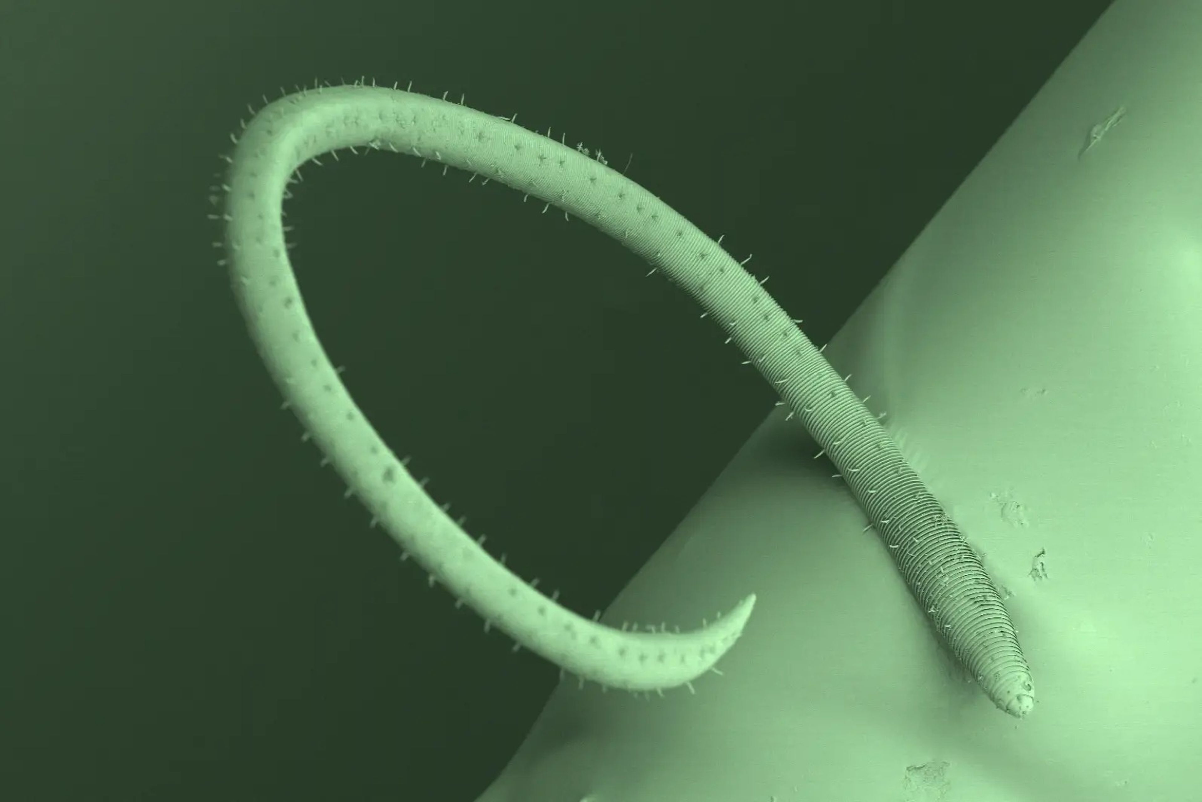 Los nematodos desmodóridos están recubiertos de diminutos órganos sensoriales similares a pelos que les ayudan a orientarse en su entorno.