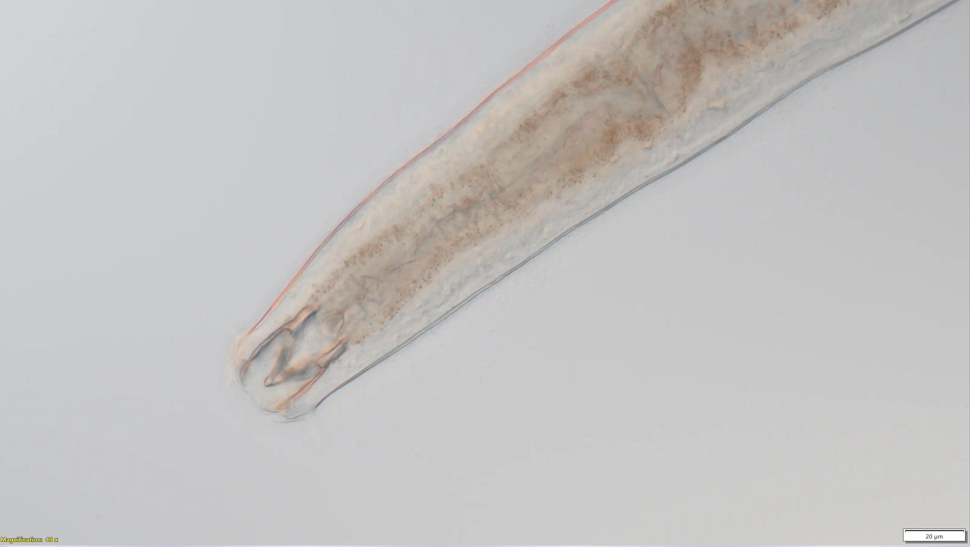 Estos nematodos Metoncholaimus tienen dientes que les ayudan a consumir presas.
