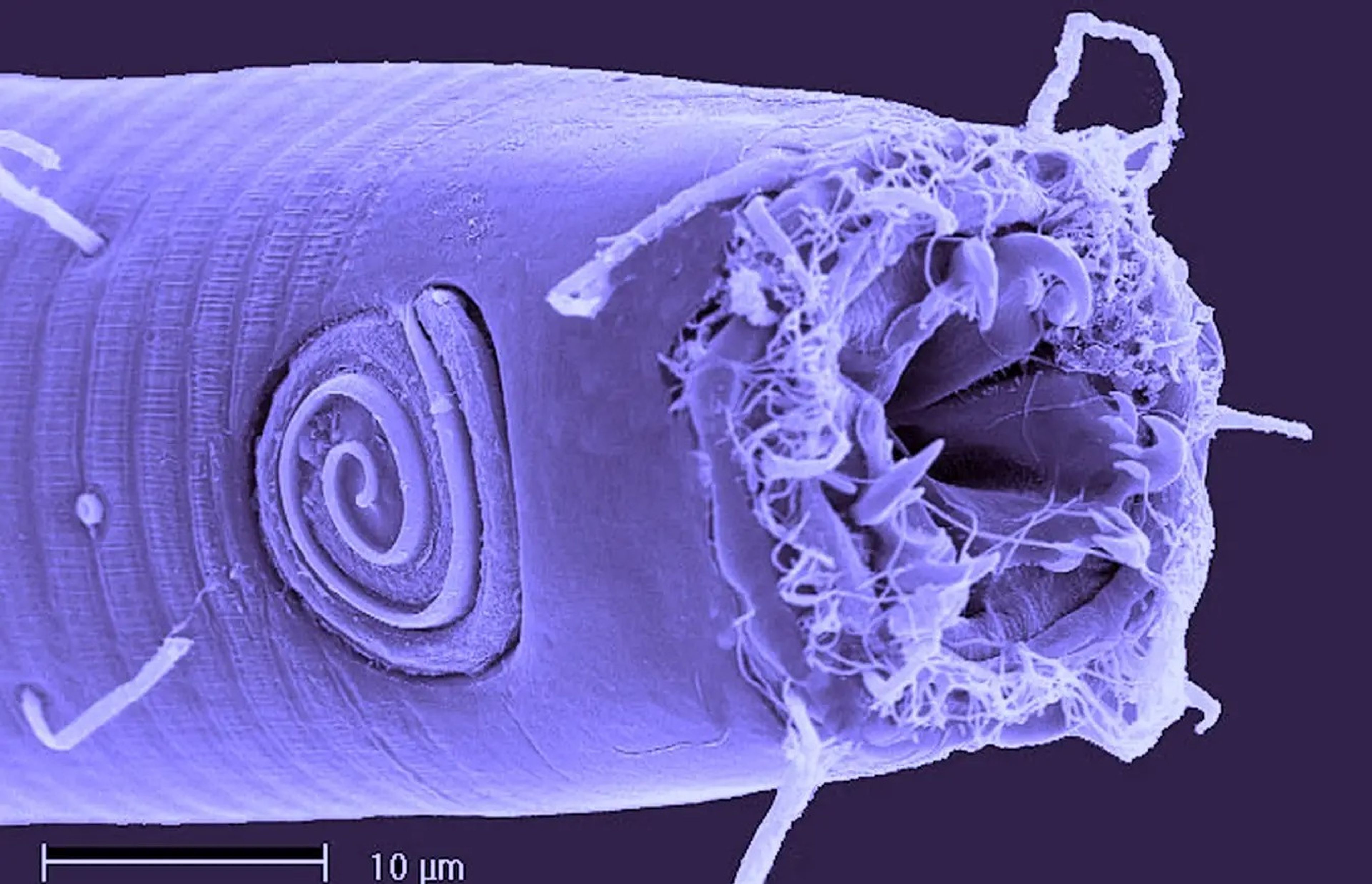 El nematodo Odontophora tiene una abertura en un extremo que parece sacada de la franquicia cinematográfica "Alien".