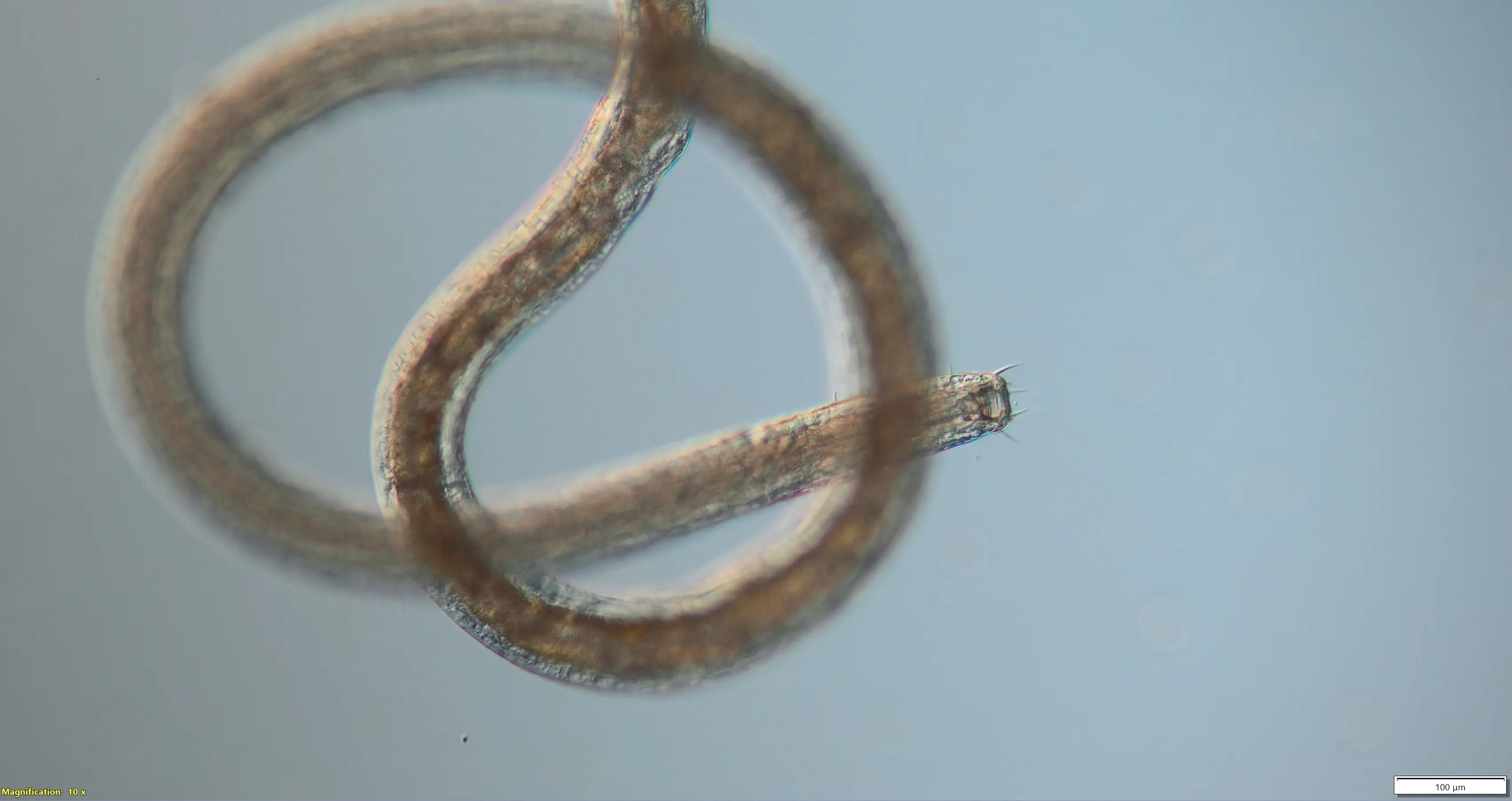 Los nematodos Pareurystomina tienen escamas dentadas que les ayudan a comerse a sus presas.