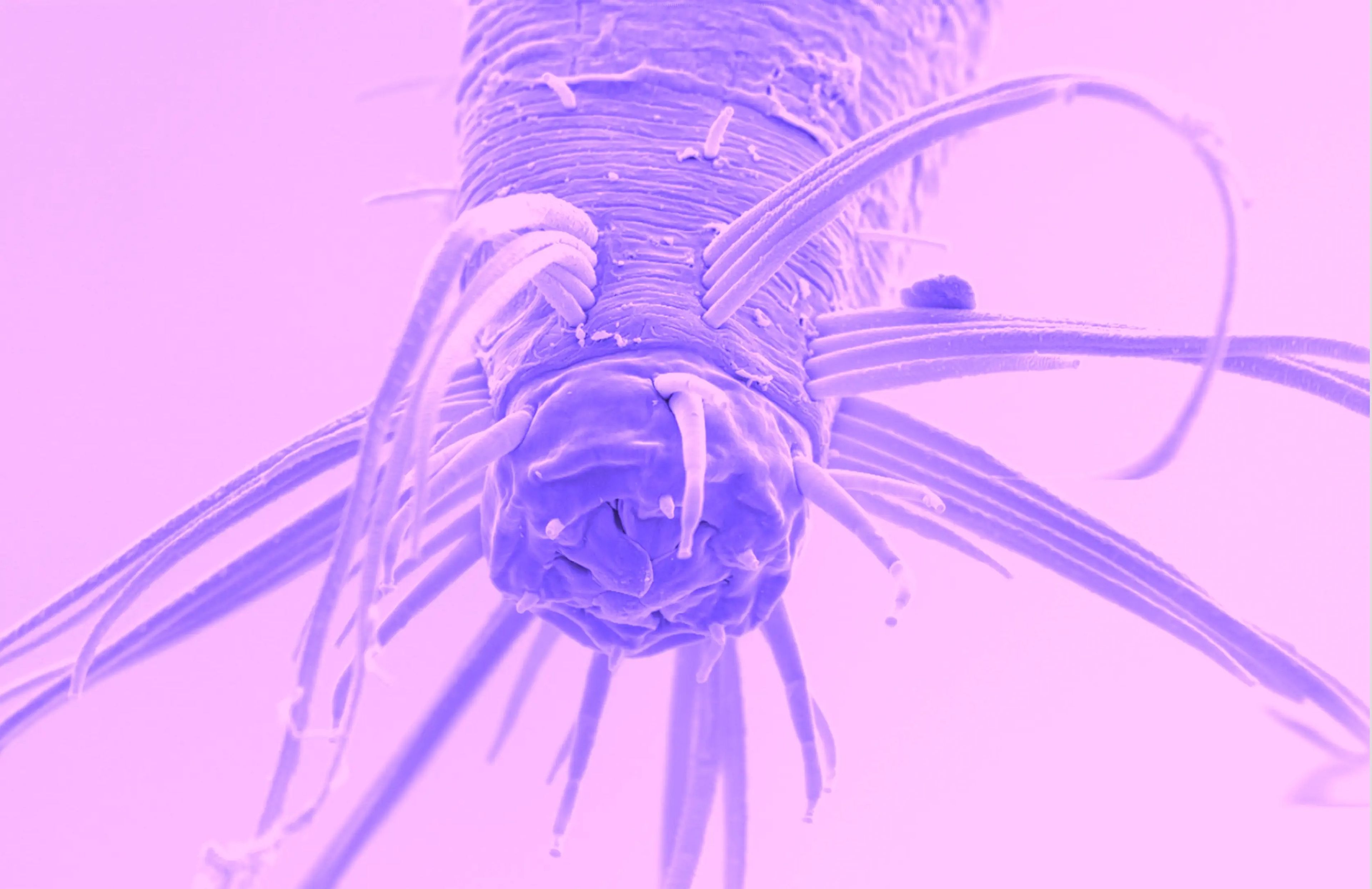Los nematodos Theristus pueden nadar para cazar presas.
