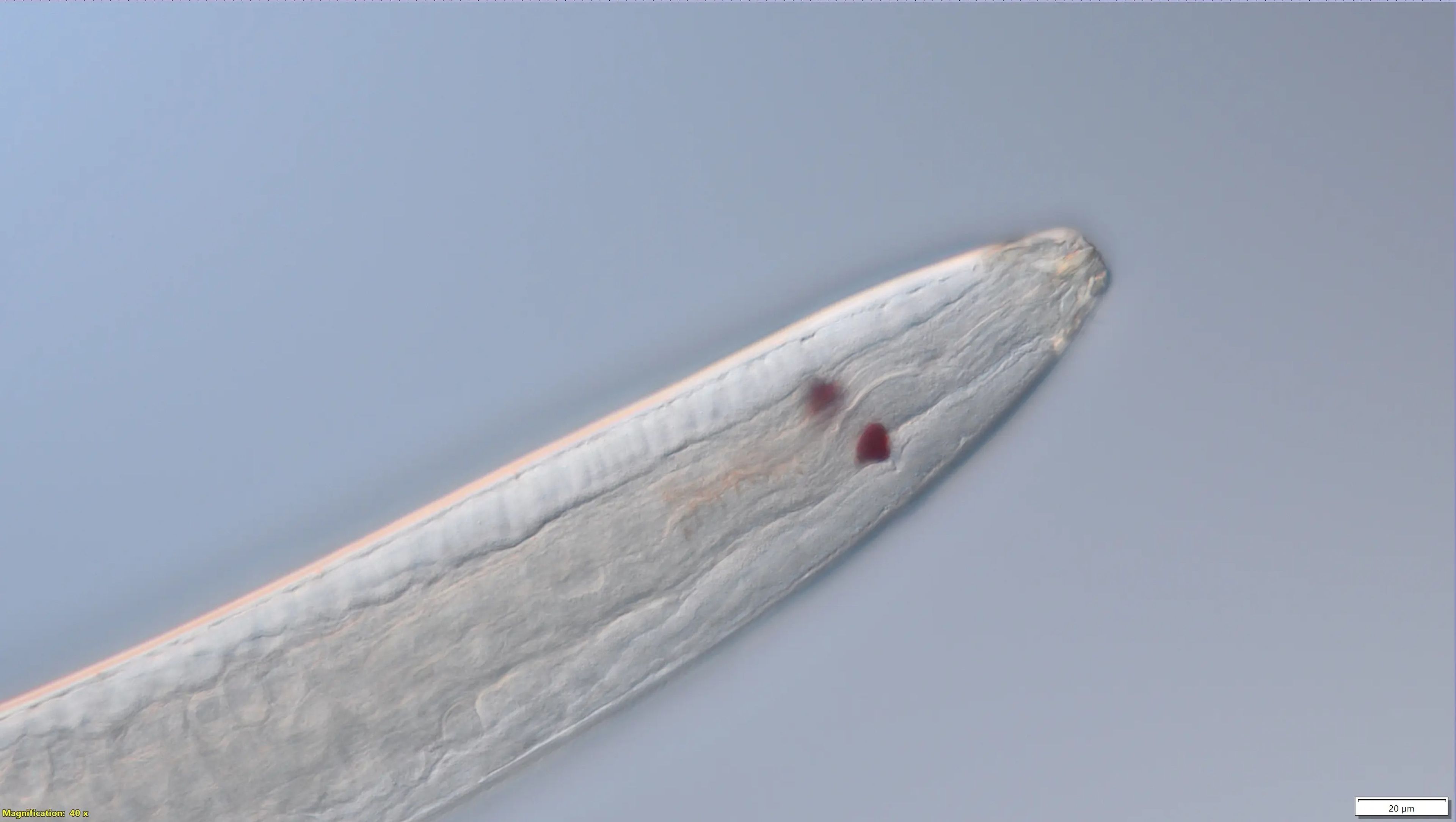 Los nematodos Thoracostoma tienen dos círculos rojos que parecen ojos y le ayudan a percibir la luz, según creen los científicos.