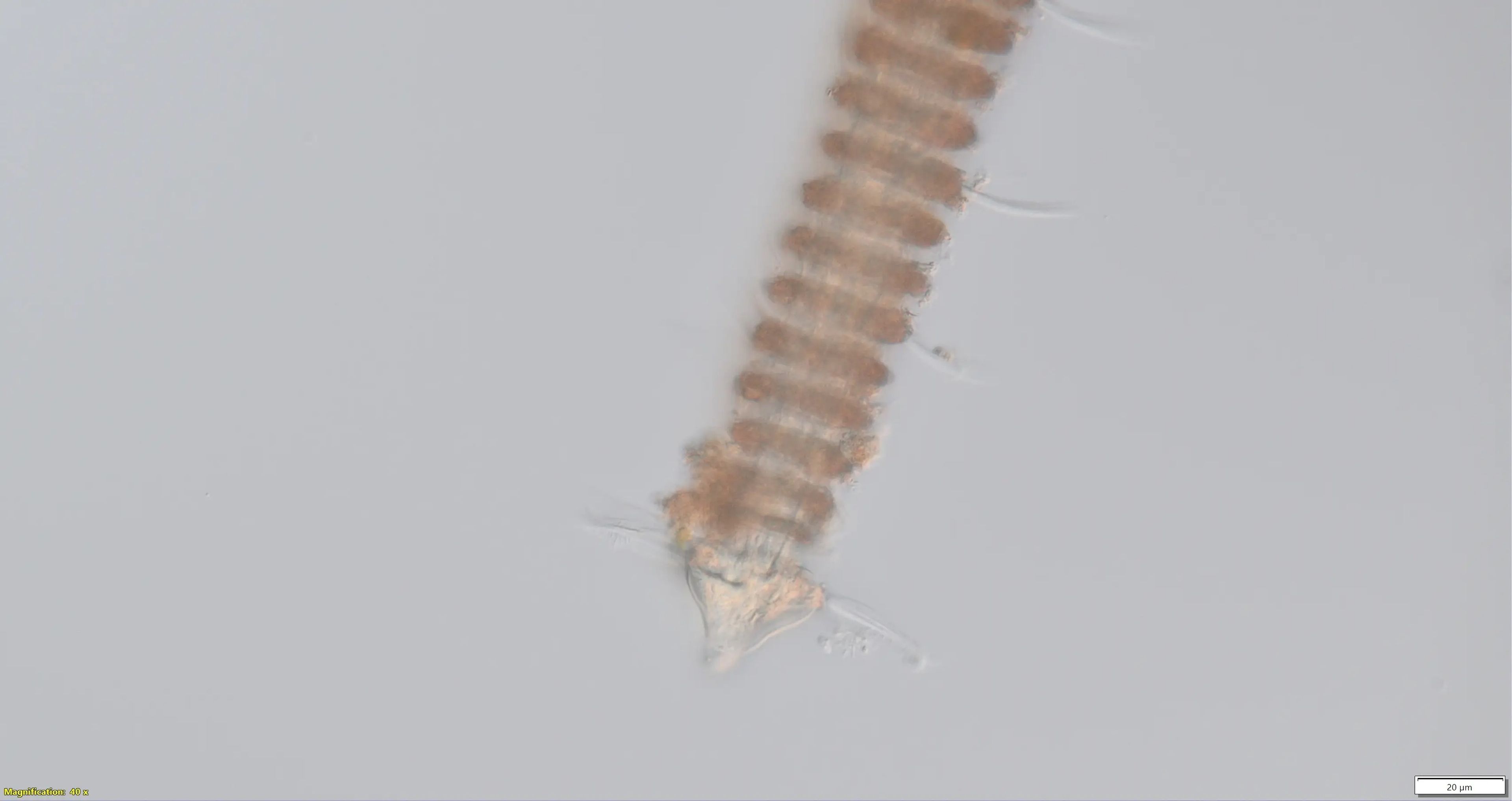 Los nematodos tricoma se distinguen por su cabeza y cuerpo triangulares que parecen anillos circulares.
