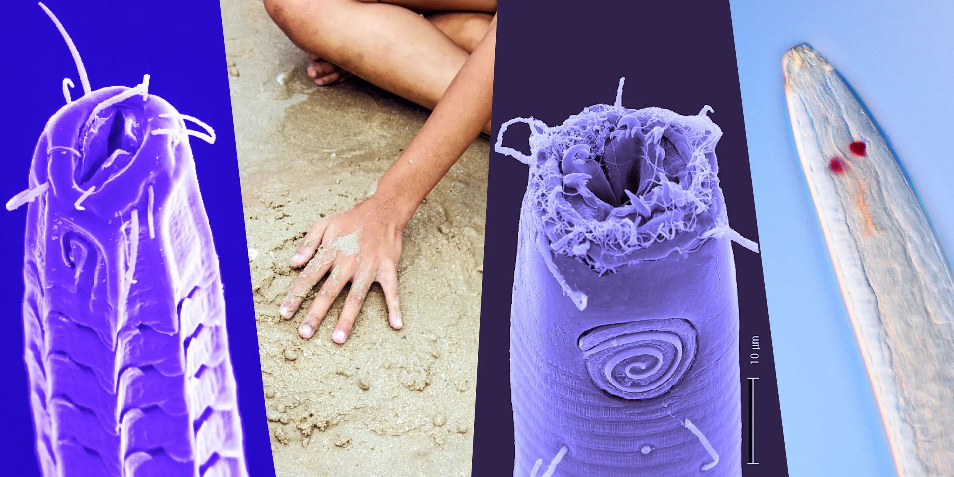 photo composite of three microscopic images of worms and an image of someone sitting with their hand in the sand