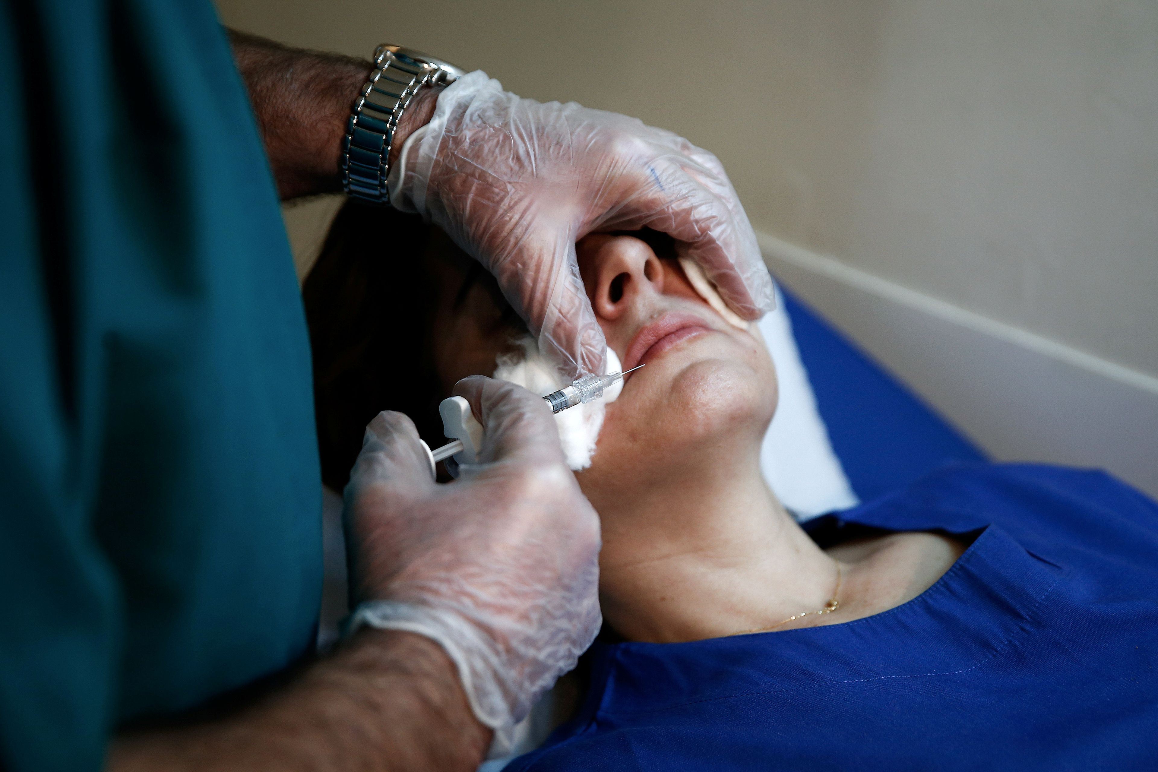 Aplicación facial de bótox en una paciente. 