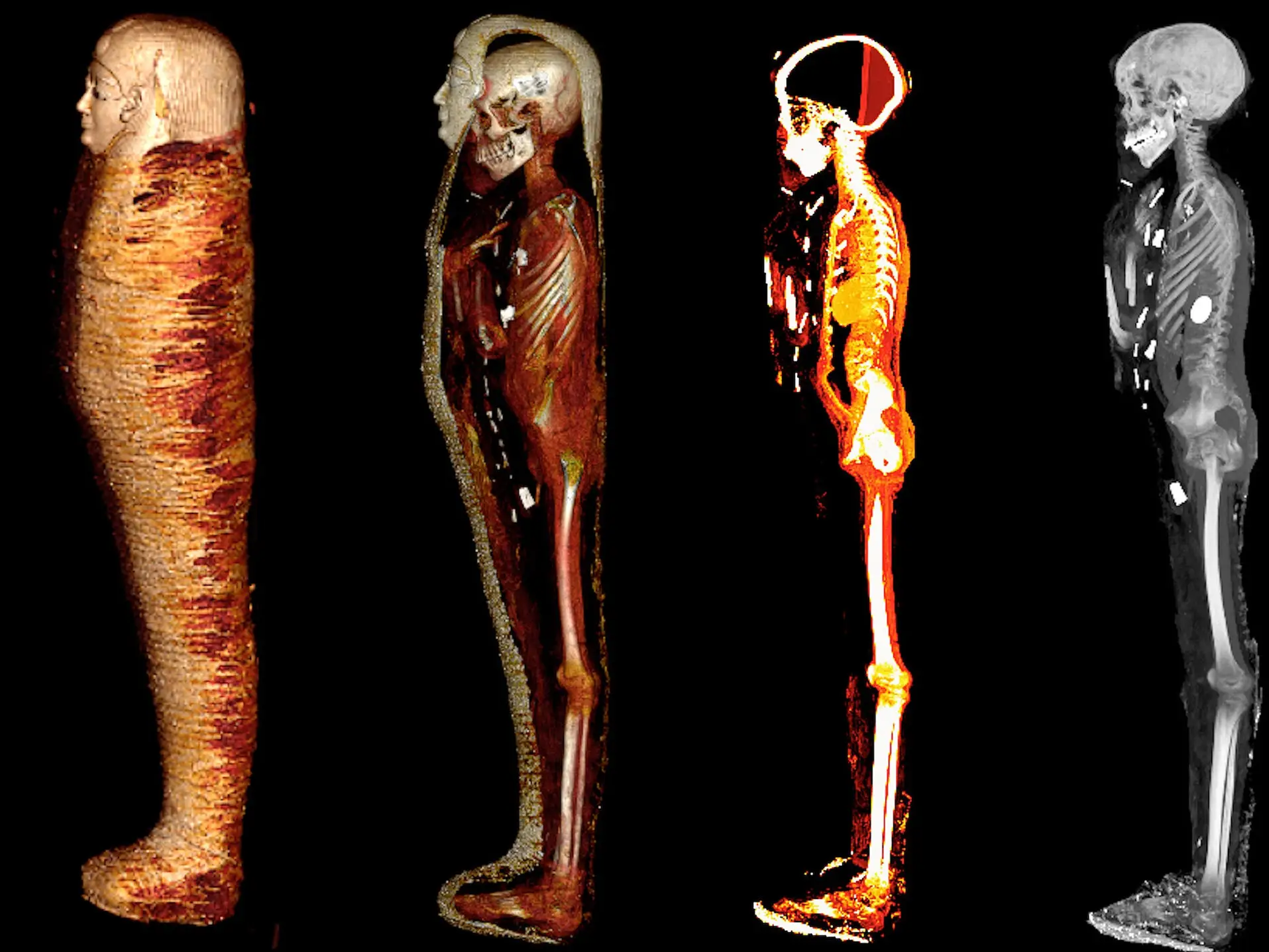 Una tomografía computarizada permitió a los científicos diseccionar digitalmente esta momia manteniéndola intacta.