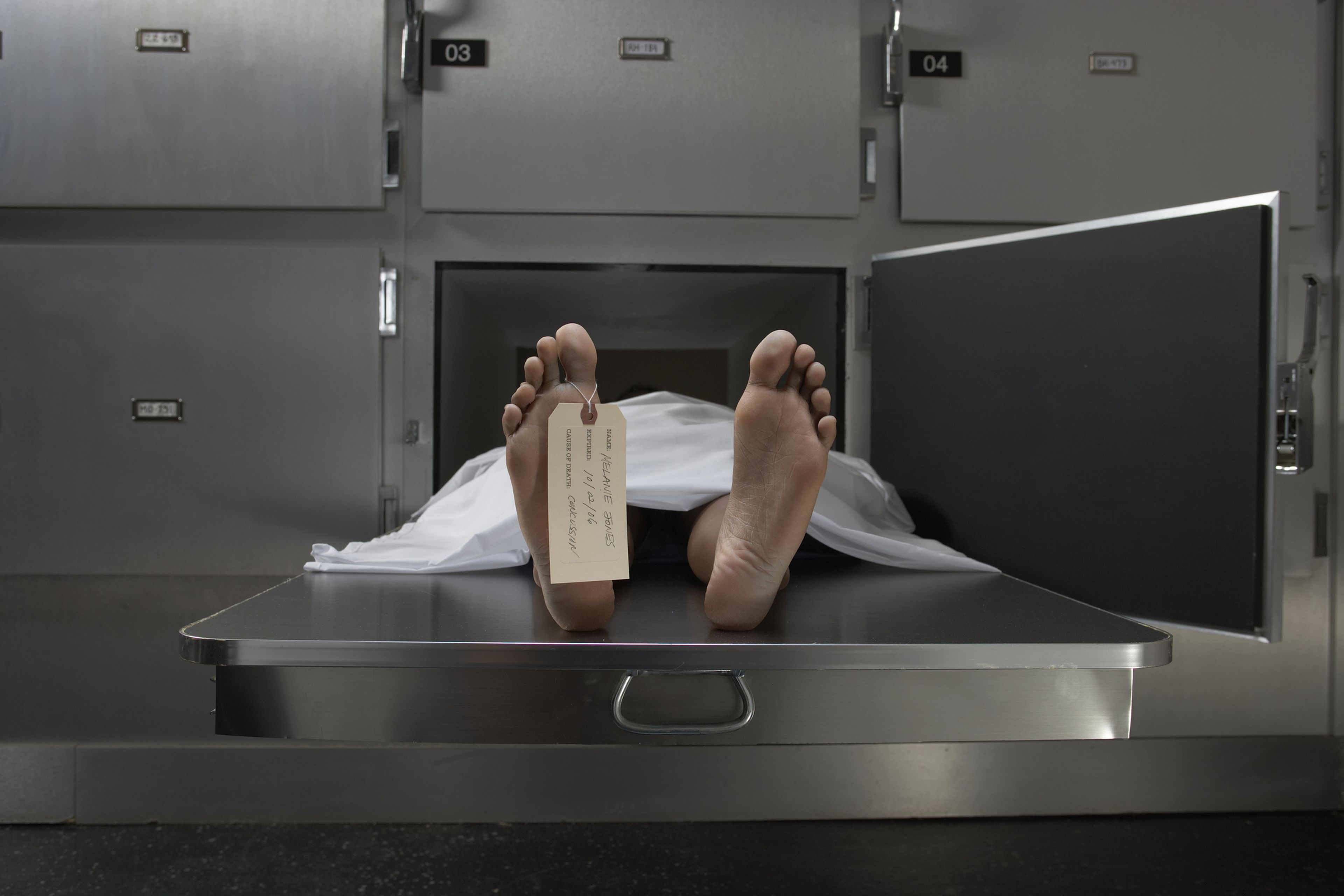 Cadáver en la morgue
