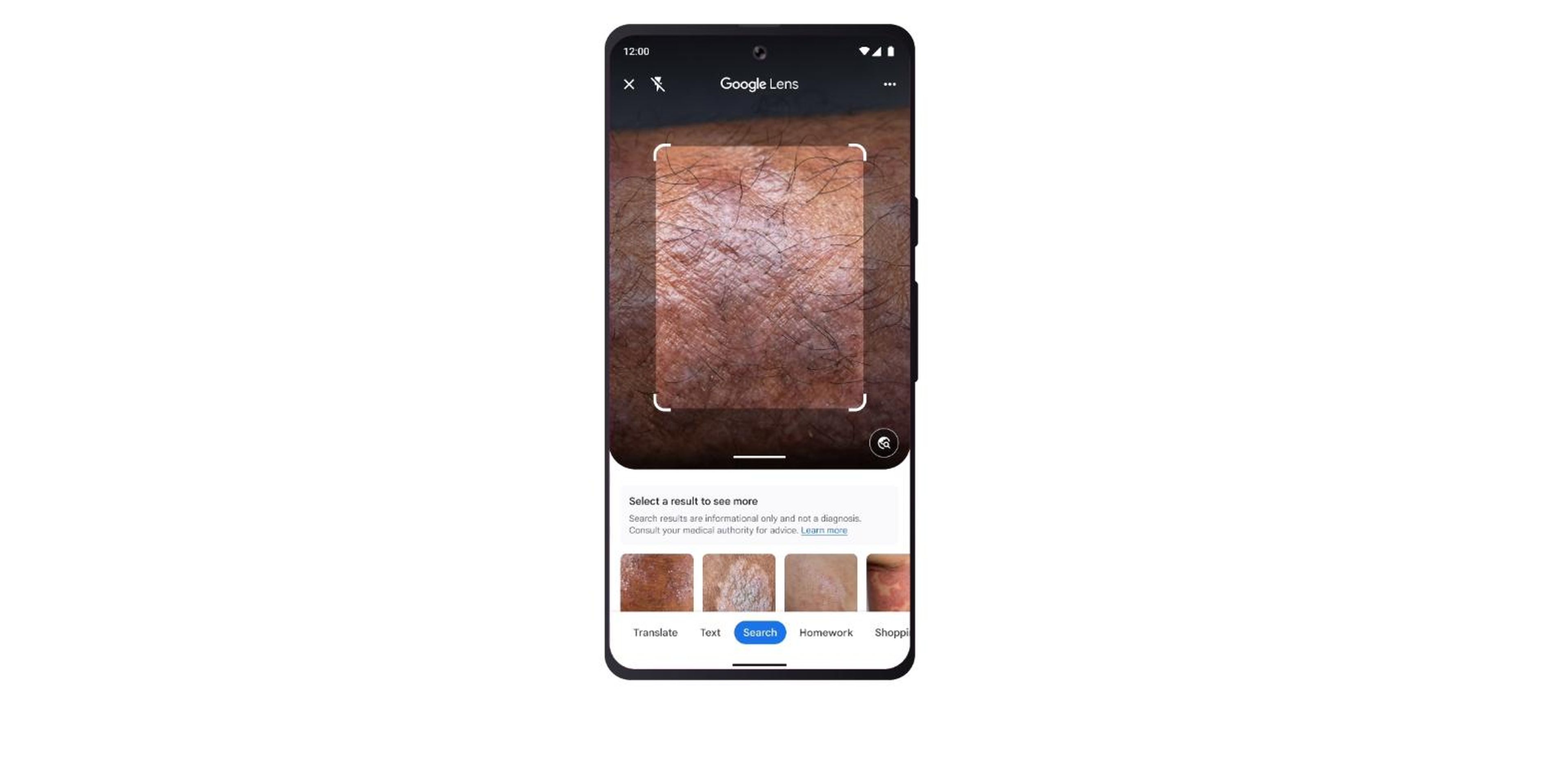 Google Lens ahora también puede buscar condiciones de la piel en base a tus propias imágenes.