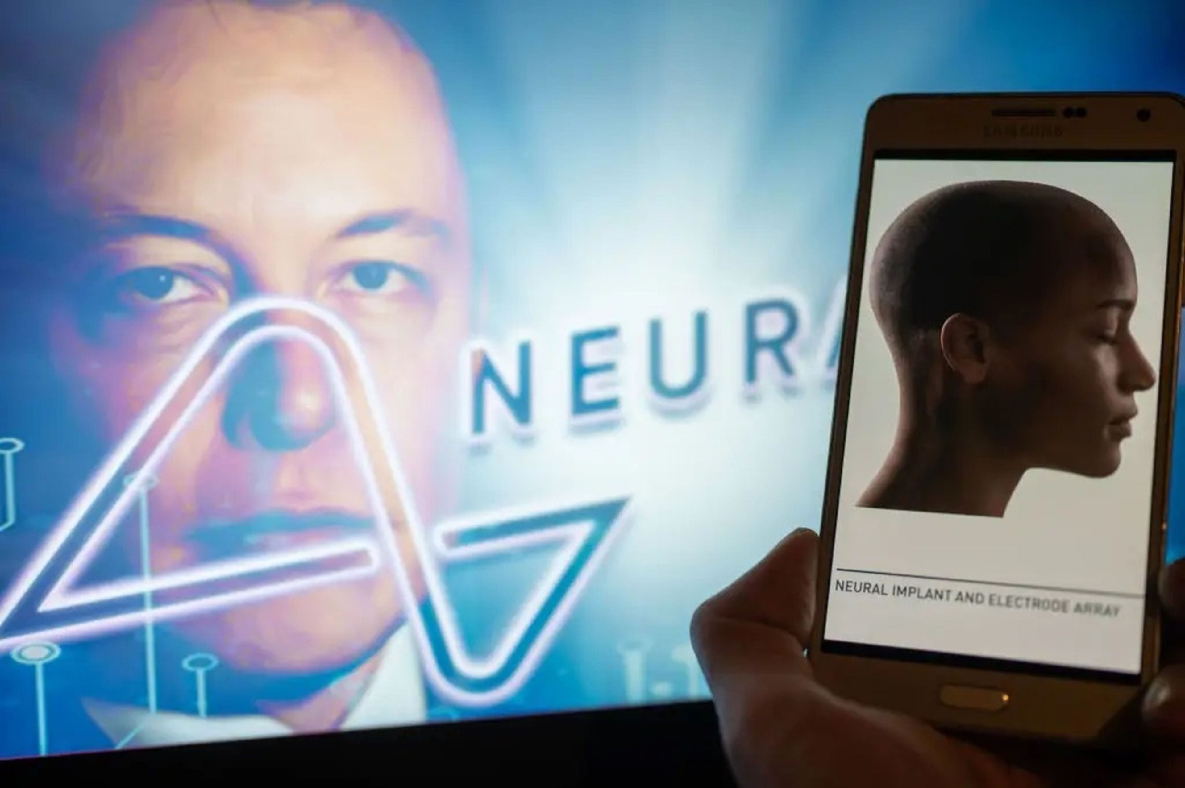 Elon Musk cofundó Neuralink en el 2016 y cinco años más tarde la empresa está a punto de comenzar sus ensayos en humanos.