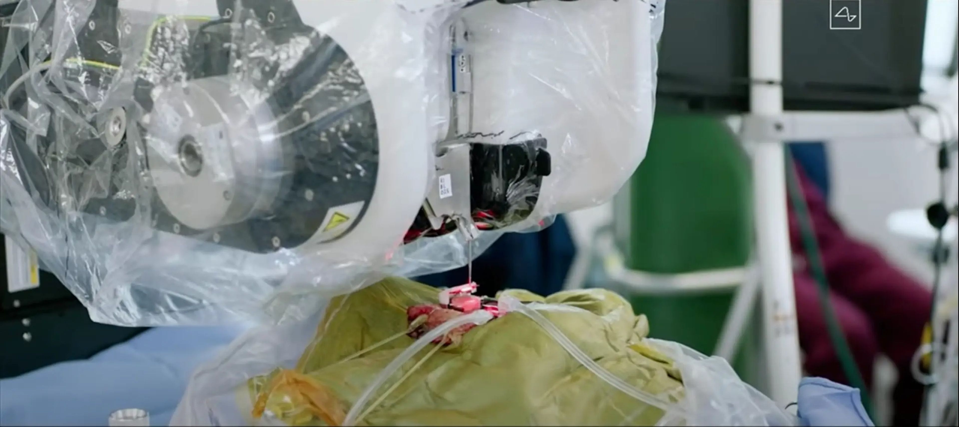 El robot Neuralink puede trabajar con fibras ultrafinas, demasiado pequeñas incluso para las manos humanas.