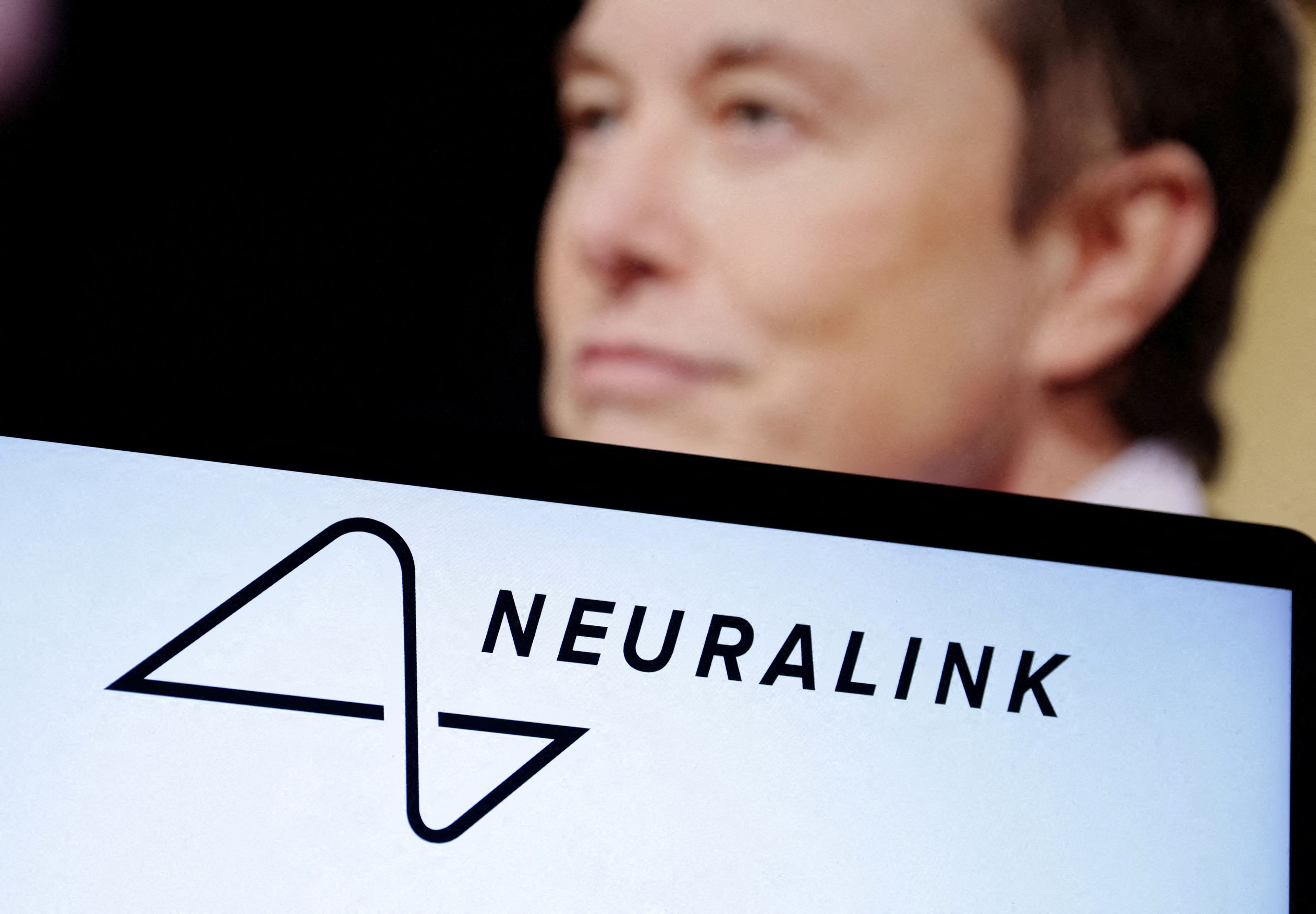 La foto del día: Elon Musk ha anunciado la implantación del primer chip cerebral de su compañía Neuralink en un ser humano. El dispositivo busca poder transmitir órdenes que ayuden a restaurar algunas funciones cerebrales gravemente dañadas 