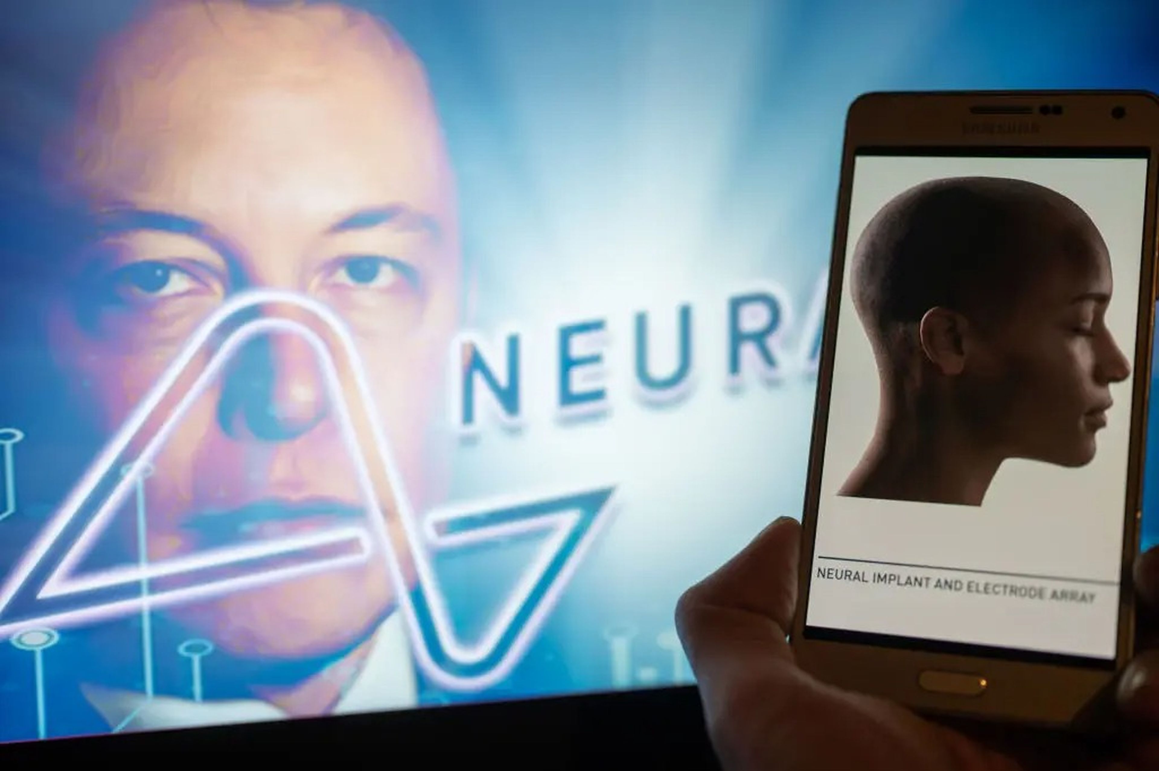 Elon Musk anuncia la implantación del primer chip Neuralink en un ser humano.