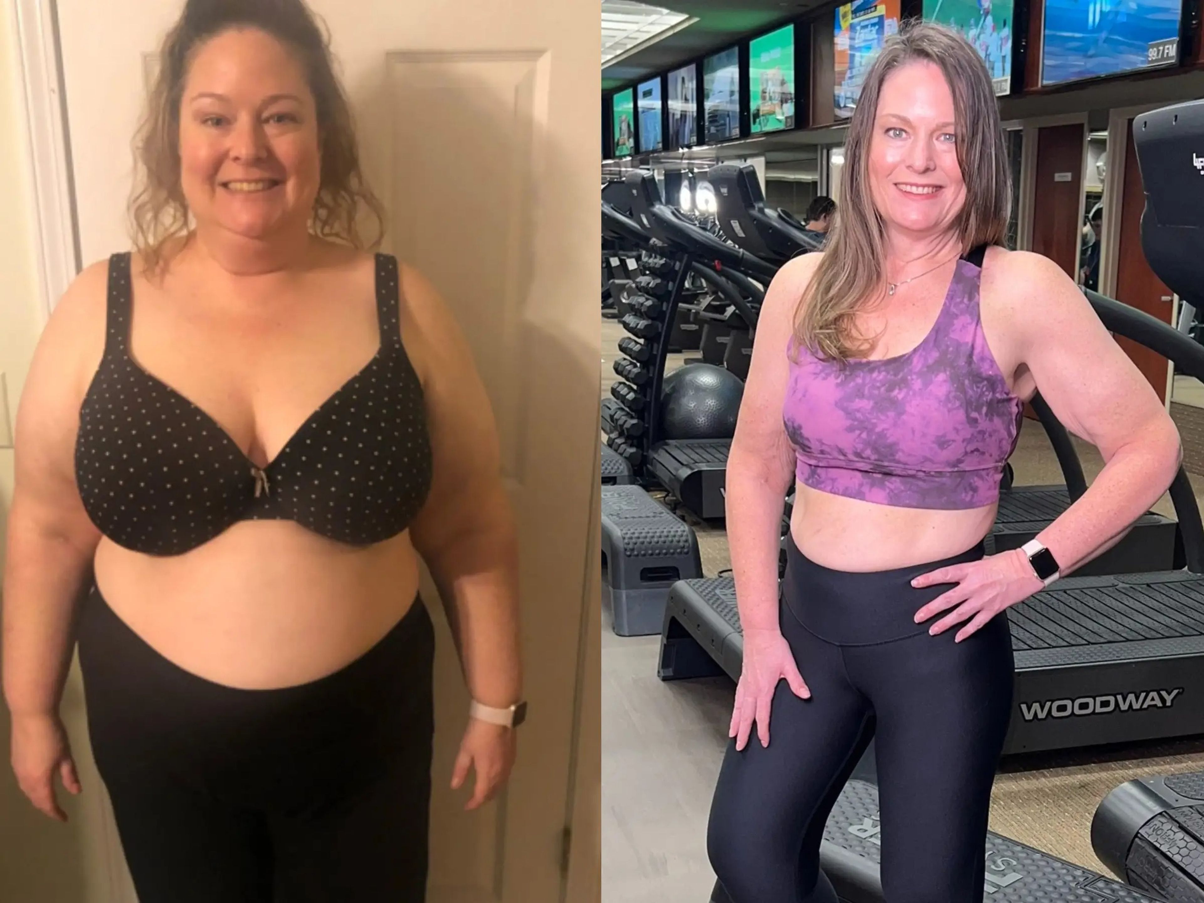 A before and after photograph of Lisa Dove who lost 160 pounds of weight.