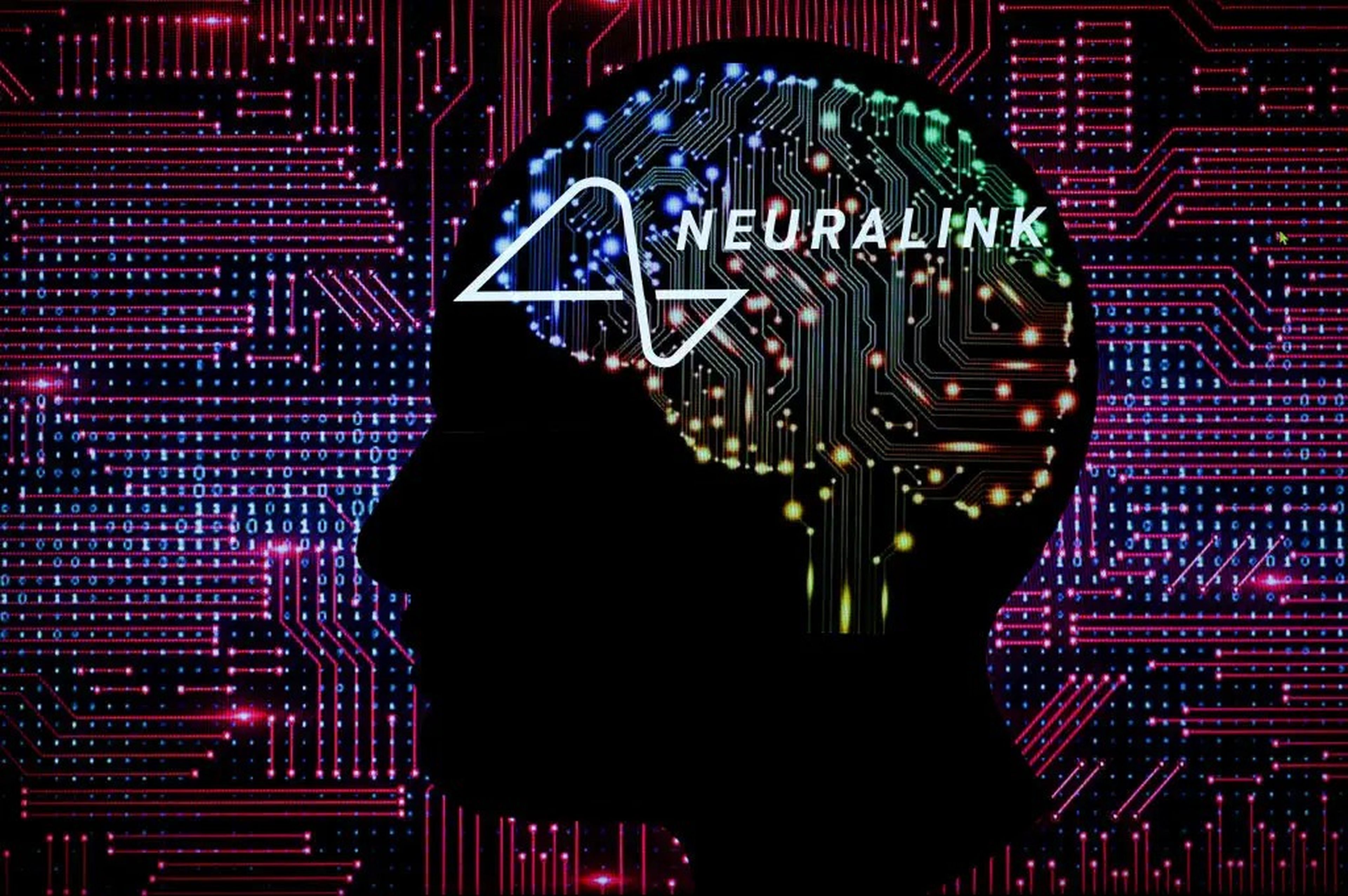 Una ilustración de Neuralink, la firma de implantes cerebrales propiedad de Elon Musk.