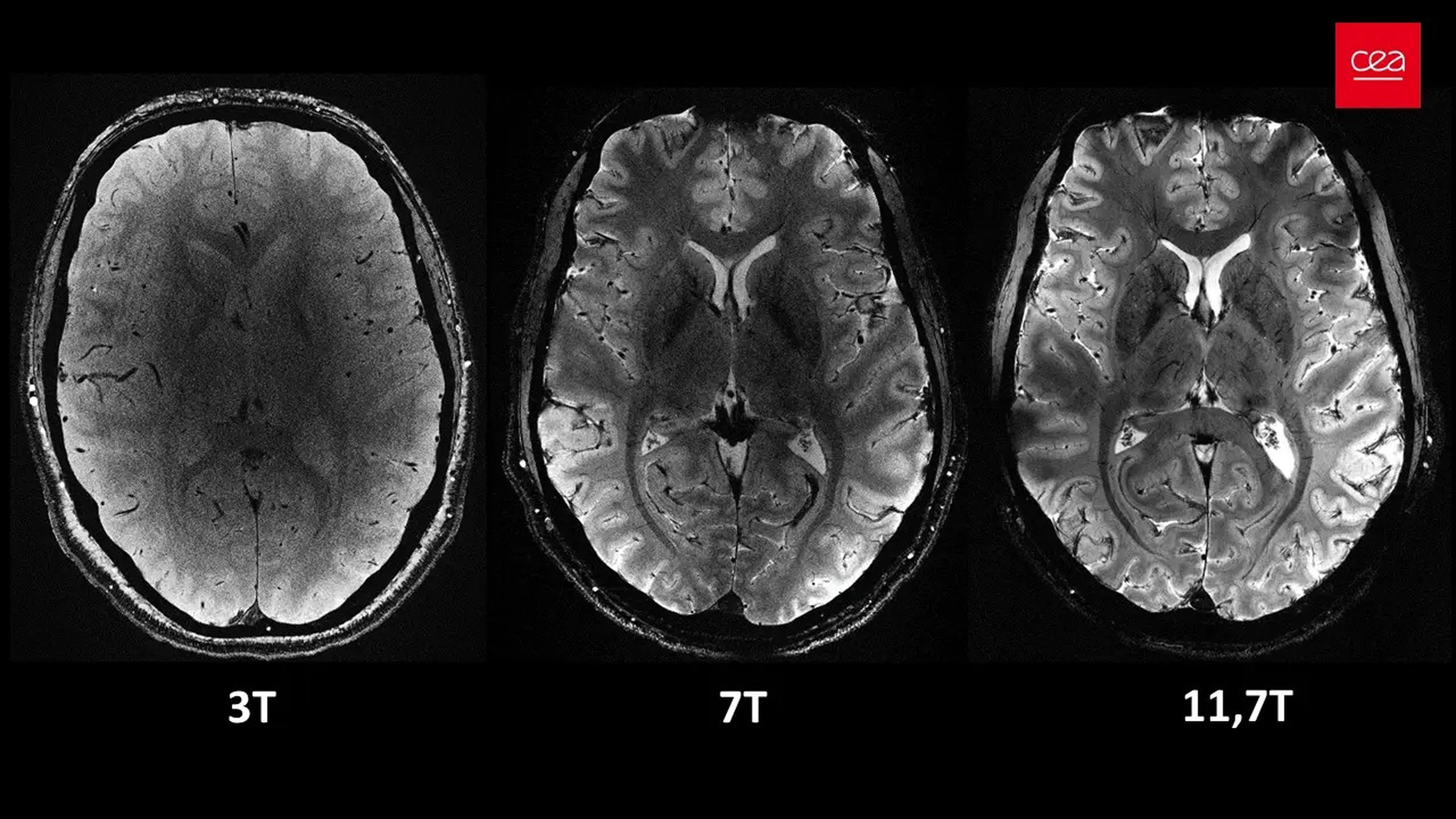 Secciones axiales del cerebro humano tomadas con tres potencias diferentes de IRM, 3T, 7T y la francesa 11,7T.