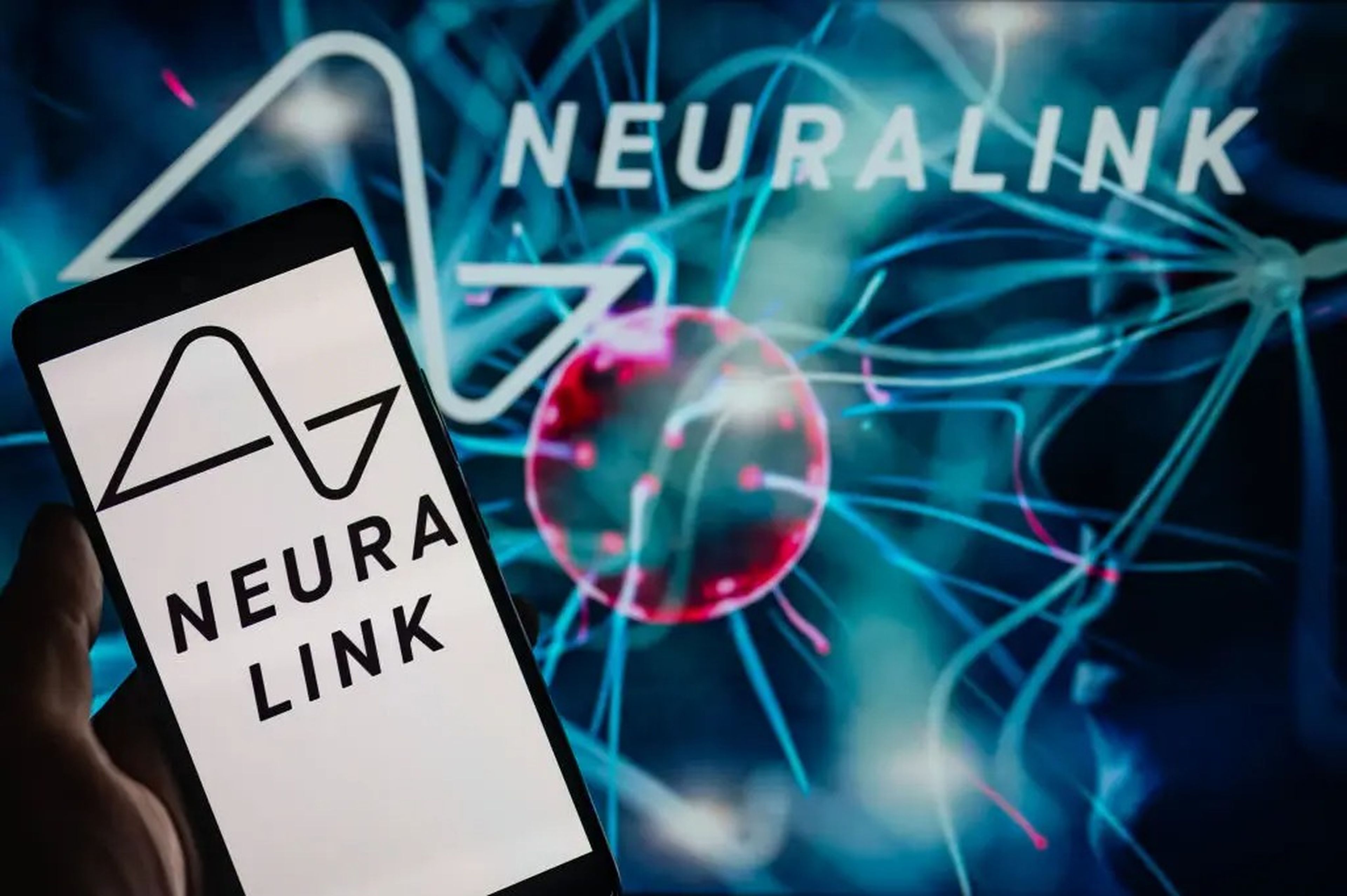 Neuralink es otra empresa de Elon Musk.