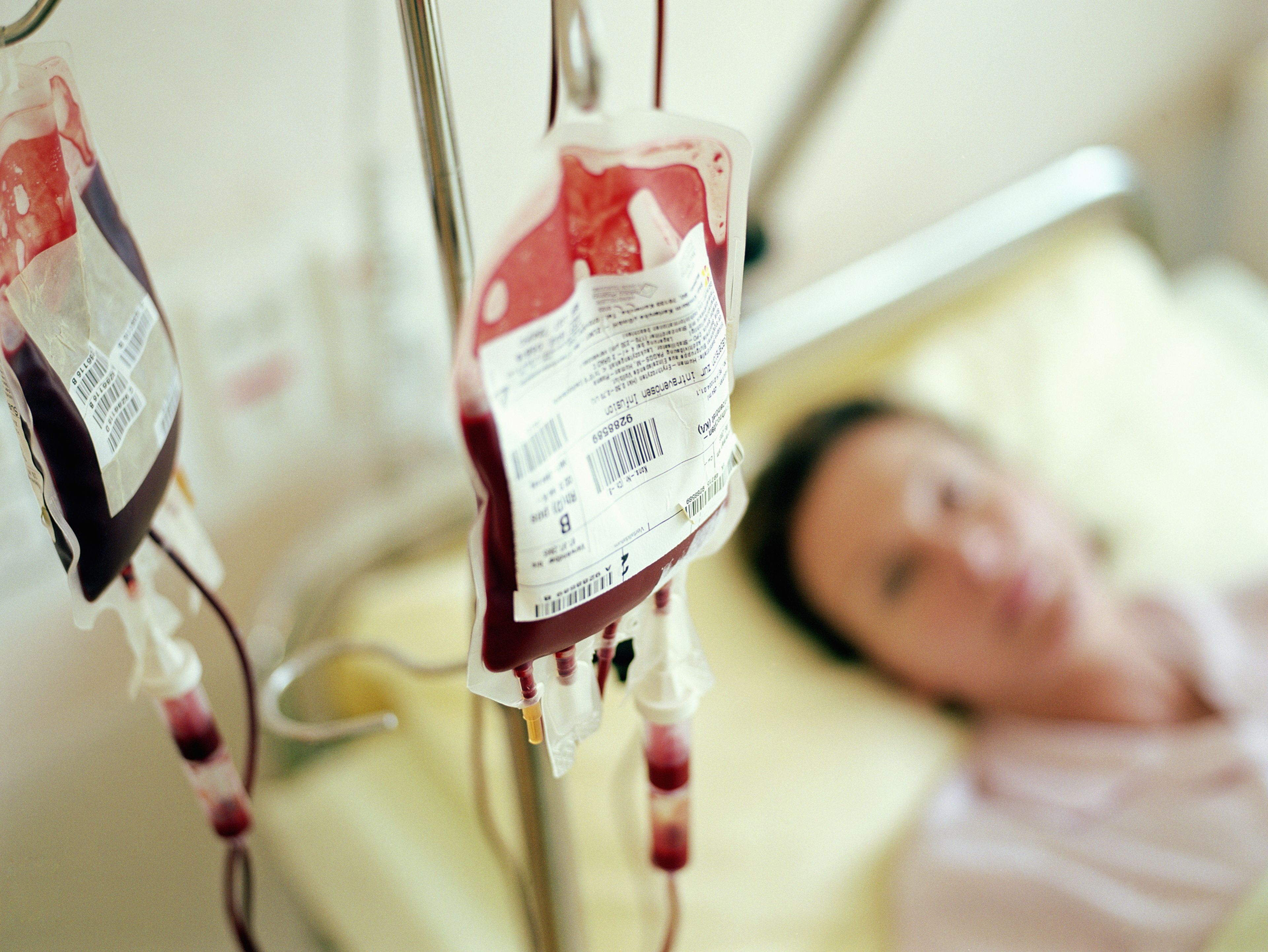 transfusión de sangre