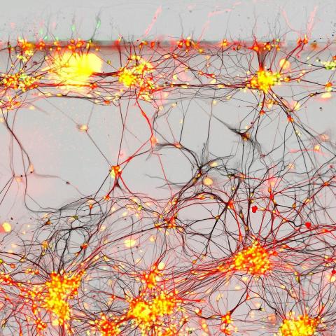 Human neurons from Parkinson patients.