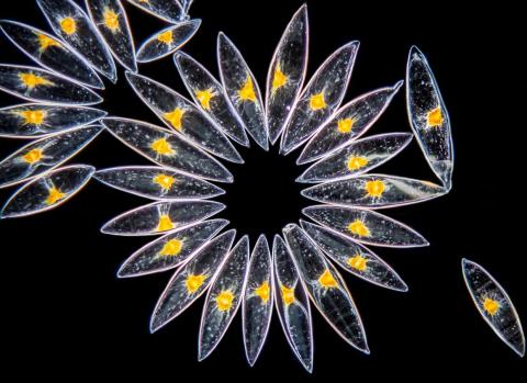 Marine organisms called dinoflagellates taken from a culture of algae.