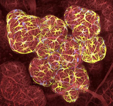 No. 17: Breast tissue, with milk-filled spheres (in red) surrounded by muscle cells that squeeze out milk (in yellow), and immune cells that detect infection (in blue).