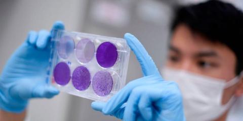 A researcher working on developing a vaccine in Brazil. Not the one by the Oxford Vaccine Group.