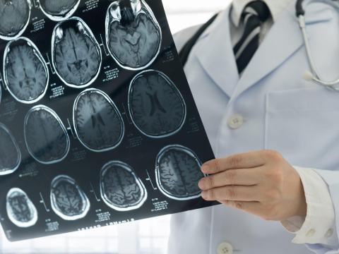 El nuevo coronavirus puede causar daños a la salud a largo plazo.