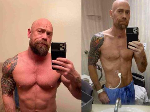 A young, fit nurse shared alarming before-and-after photos showing the impact the coronavirus had on his body A young, fit nurse shared alarming before-and-after photos showing the impact the coronavirus had on his body