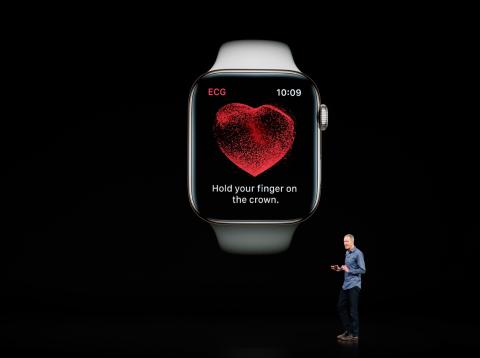 Electrocardiograma del Apple Watch