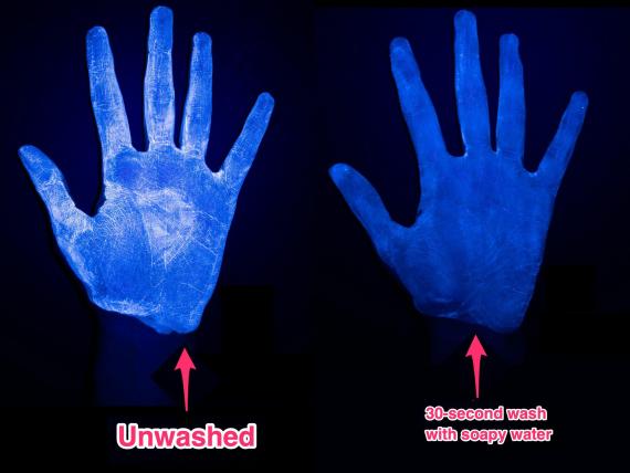 Las fotos muestran por qué el desinfectante de manos no funciona tan bien como el jabón y el agua para eliminar gérmenes